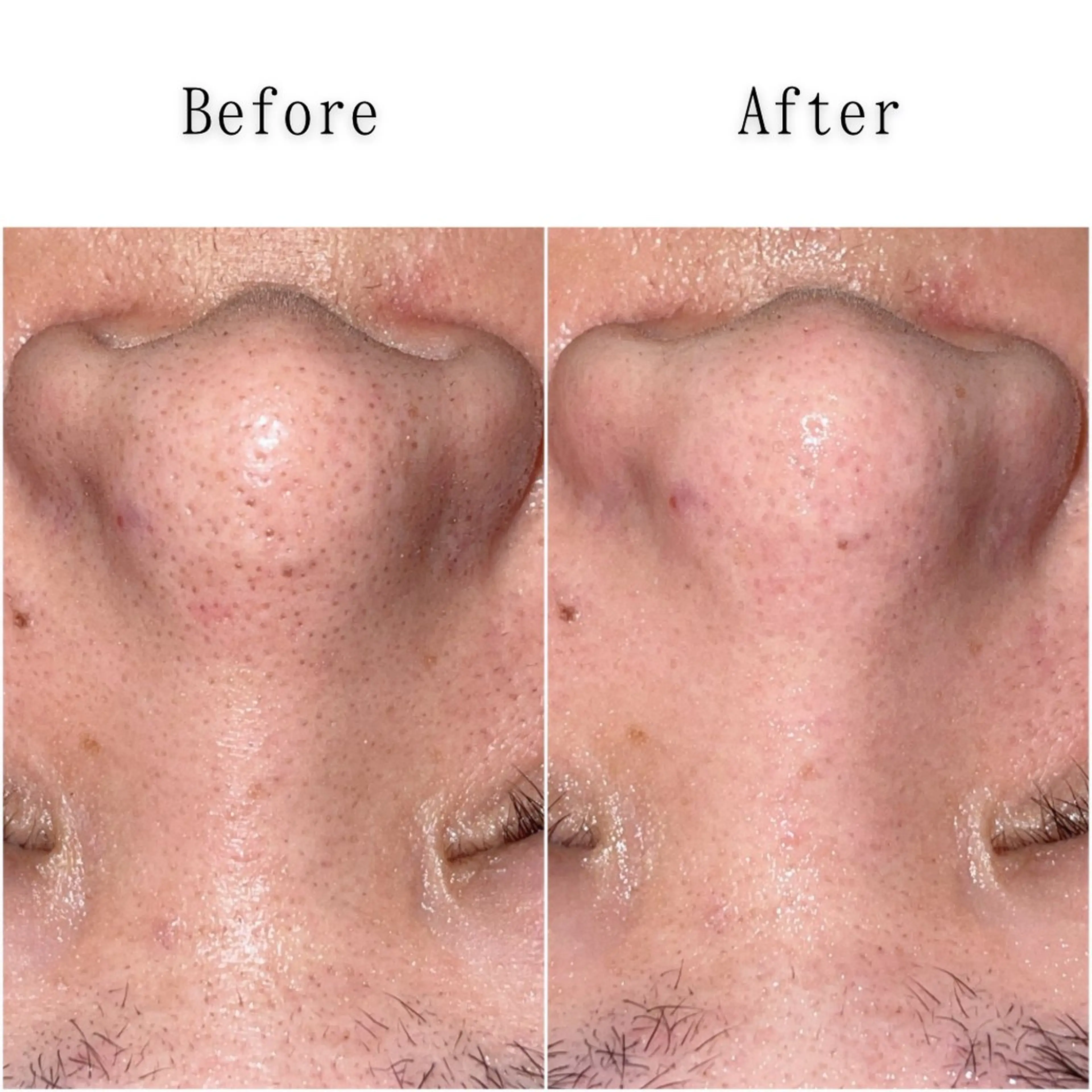 その他 SELF  BEAUTY gracia浦添店所属・gracia 浦添店のその他イメージ