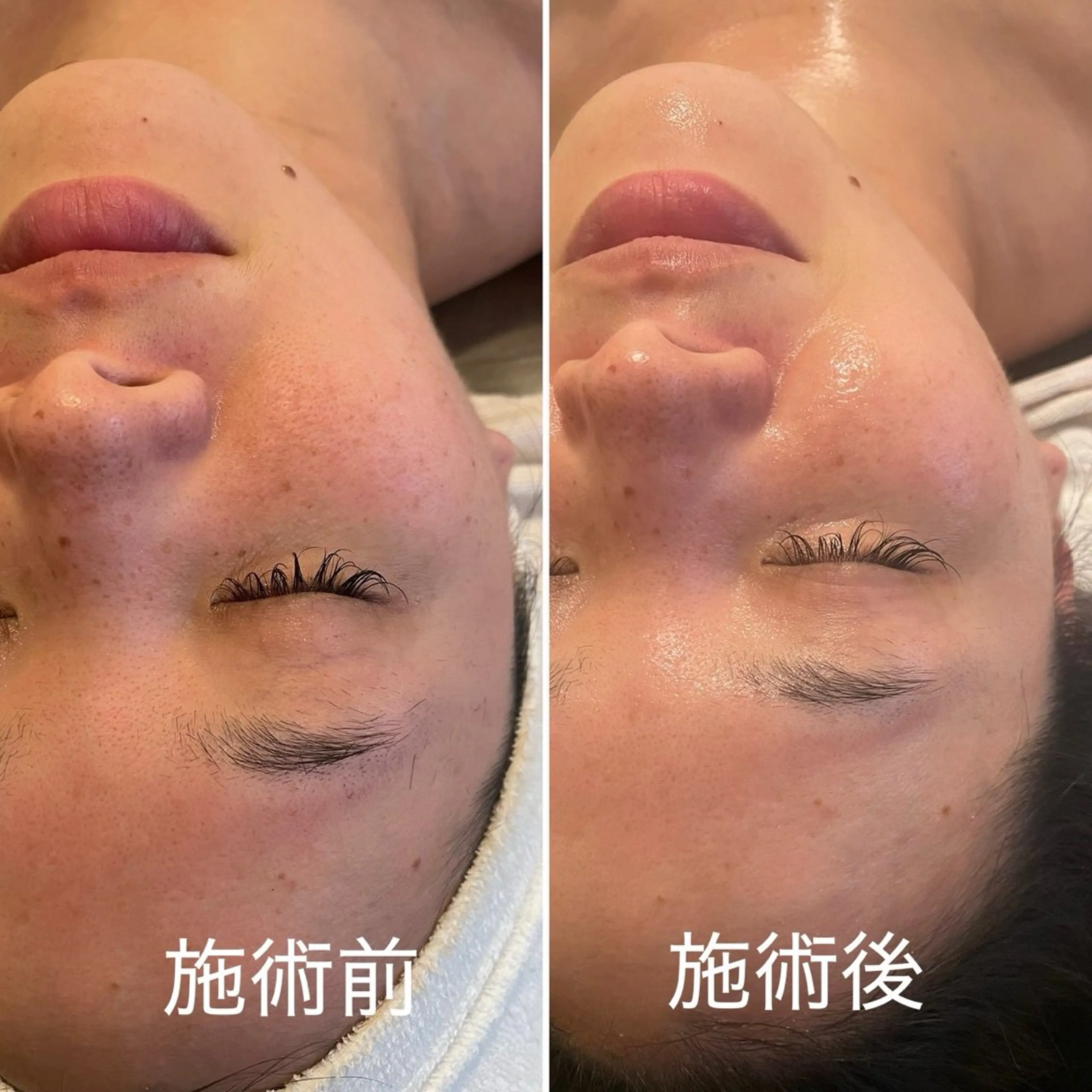 エステ ビューティーサロン ソナタのエステ・リラクイメージ