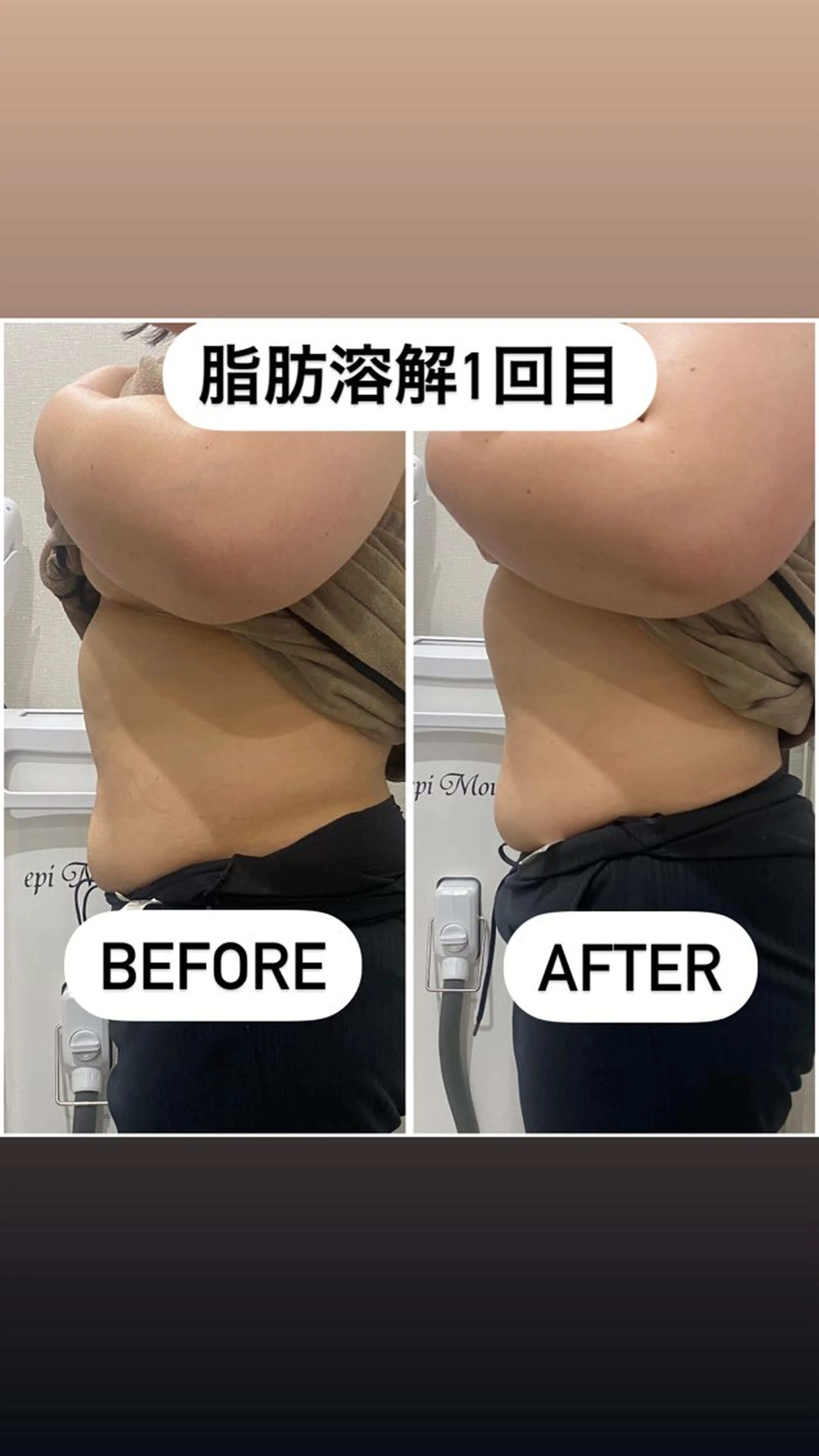 エステ 毛穴洗浄・痩身・脱毛 /アルカンジュのエステ・リラクイメージ