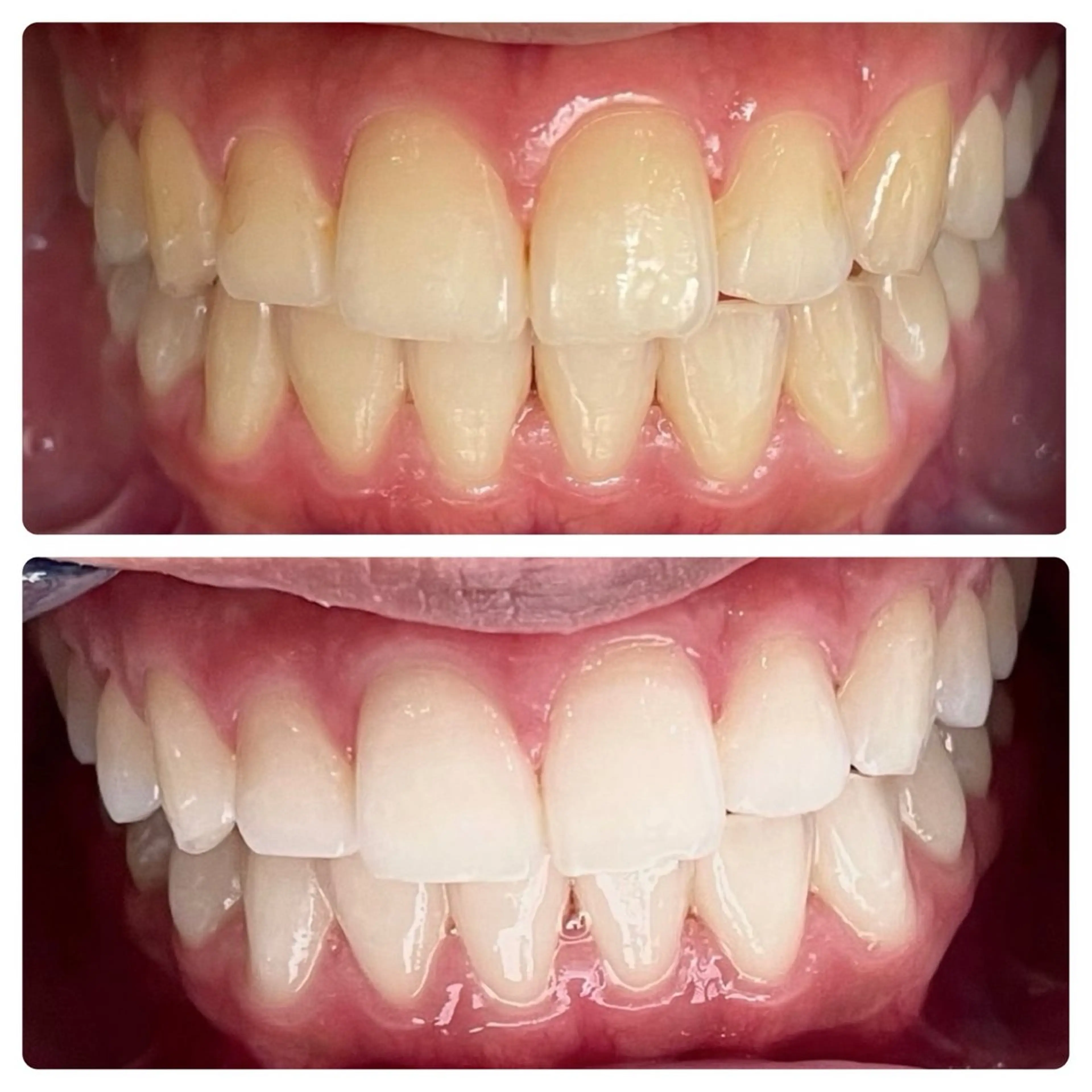 セルフホワイトニング サクッとホワイト   立川店所属・サクッとホワイト 立川店のその他イメージ