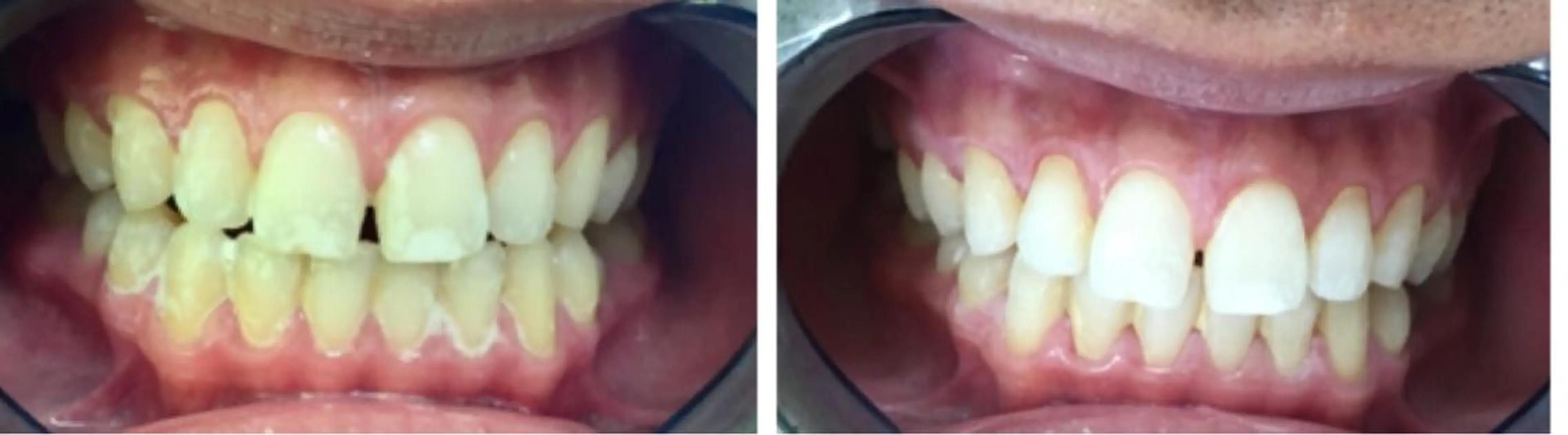 メンズ NATURE所属・菅沼 奈津子のエステ・リラクイメージ