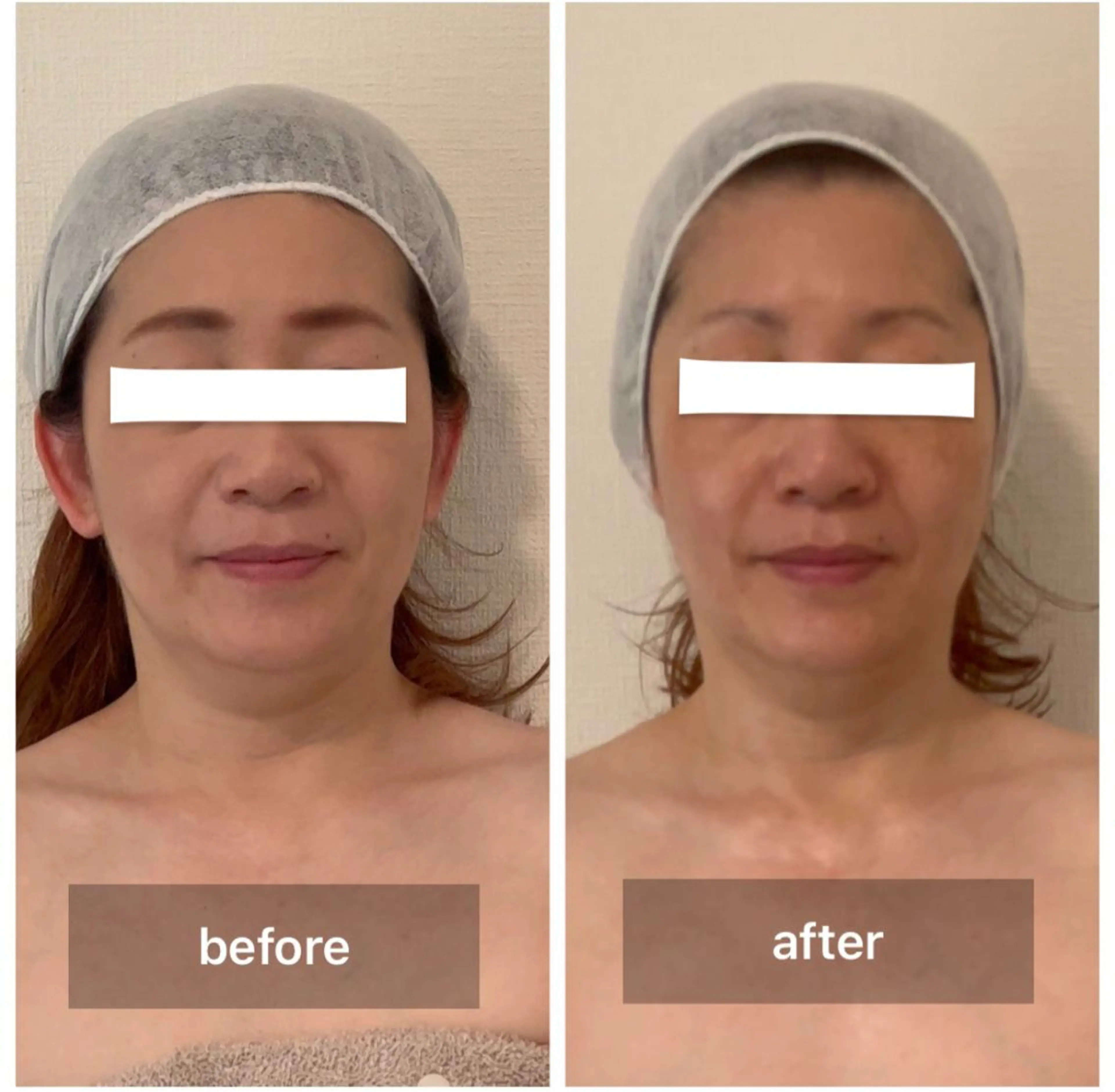 Eclavie所属・エクラヴィ 小顔・エイジングケアのエステ・リラクイメージ