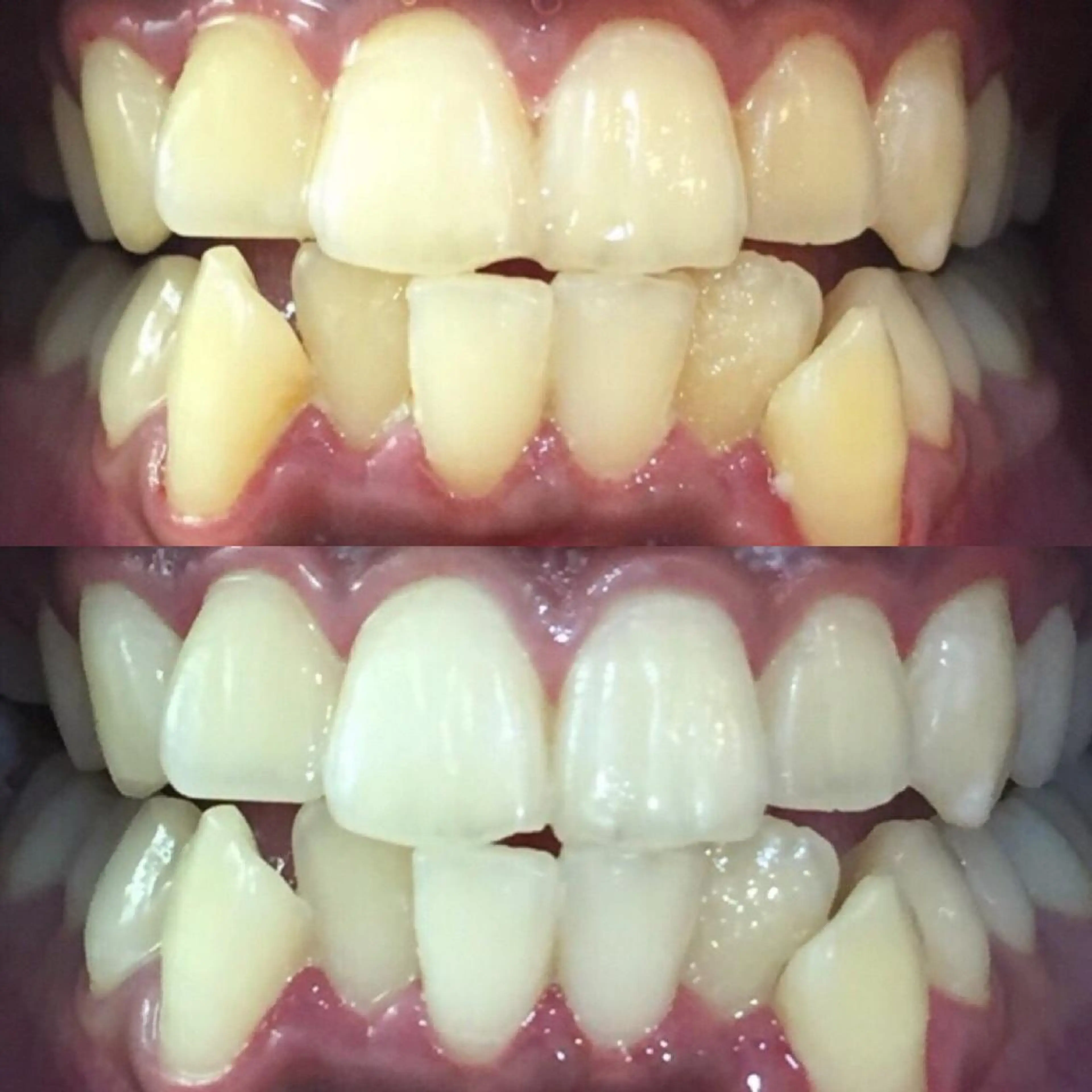 ロング カラー パーマ ヘアアレンジ ネイル マツエク・マツパ アイブロウ ホワイト LBSホワイトニング 🌐梅田店公式のその他イメージ