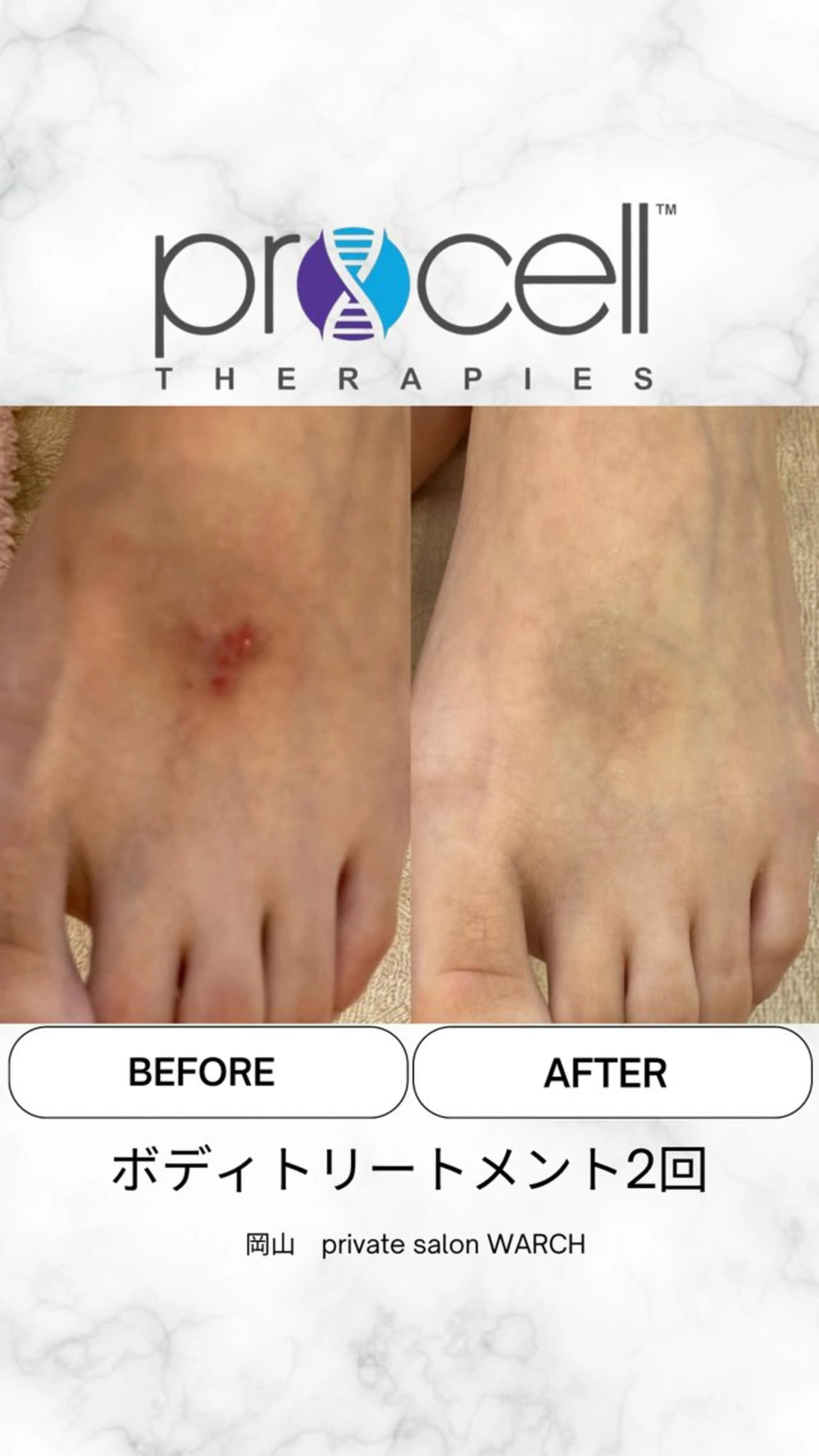 WARCH Marieのその他イメージ