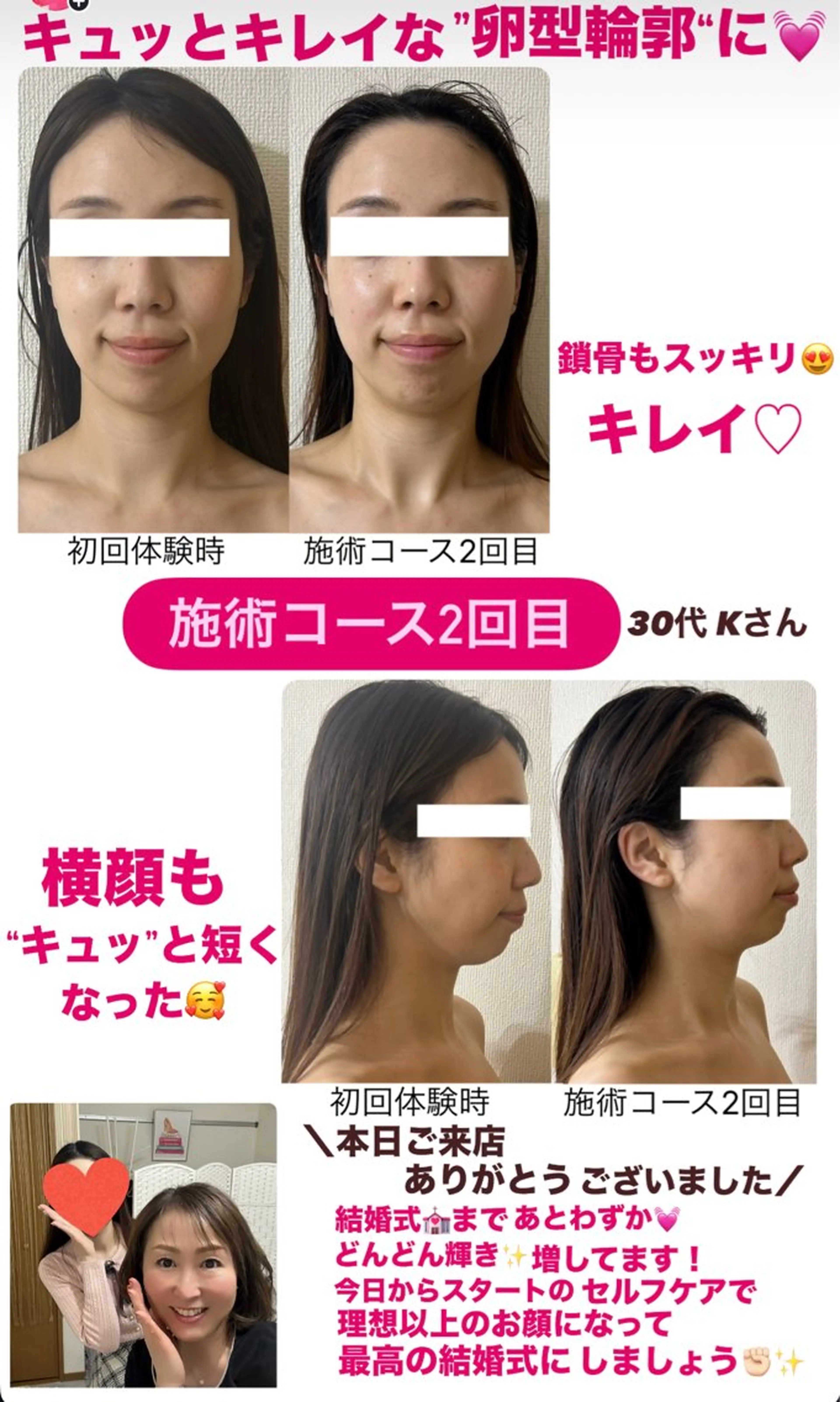 la lumie're (ラ リュミエール)所属・小顔サロン (ラ リュミエール)のエステ・リラクイメージ