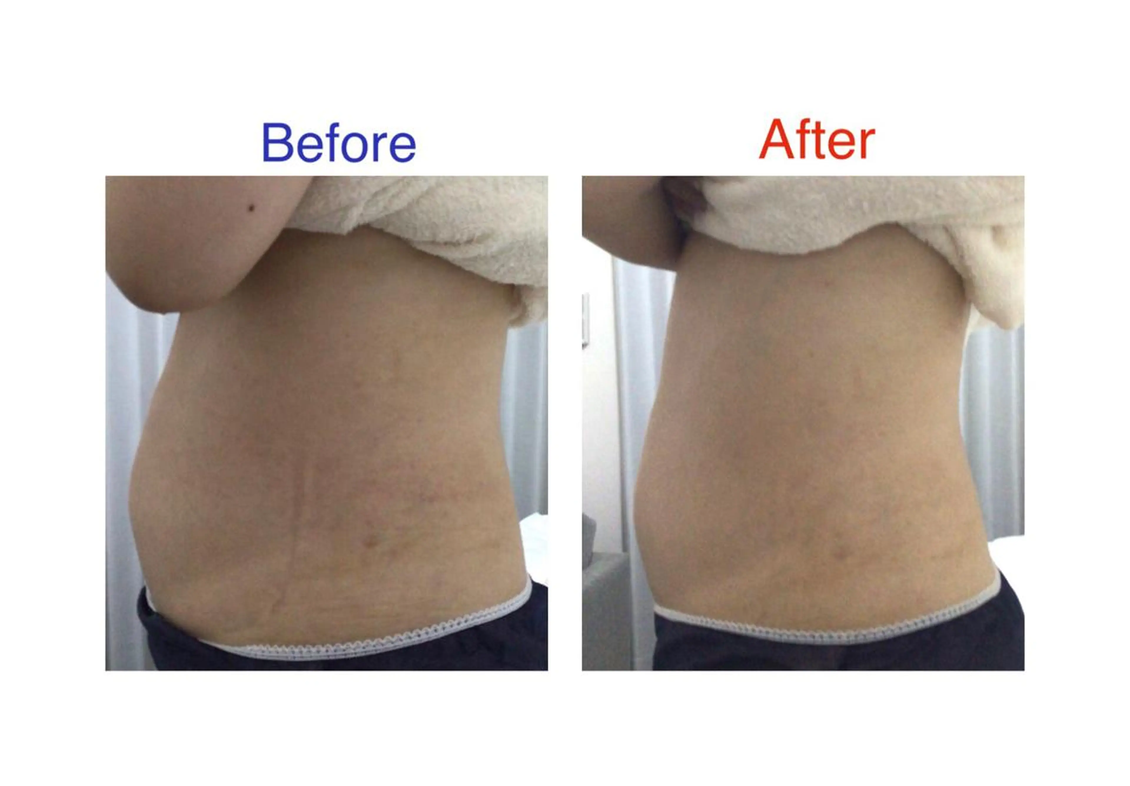 子宮矯正/腸揉み/ シュガーリング脱毛のエステ・リラクイメージ