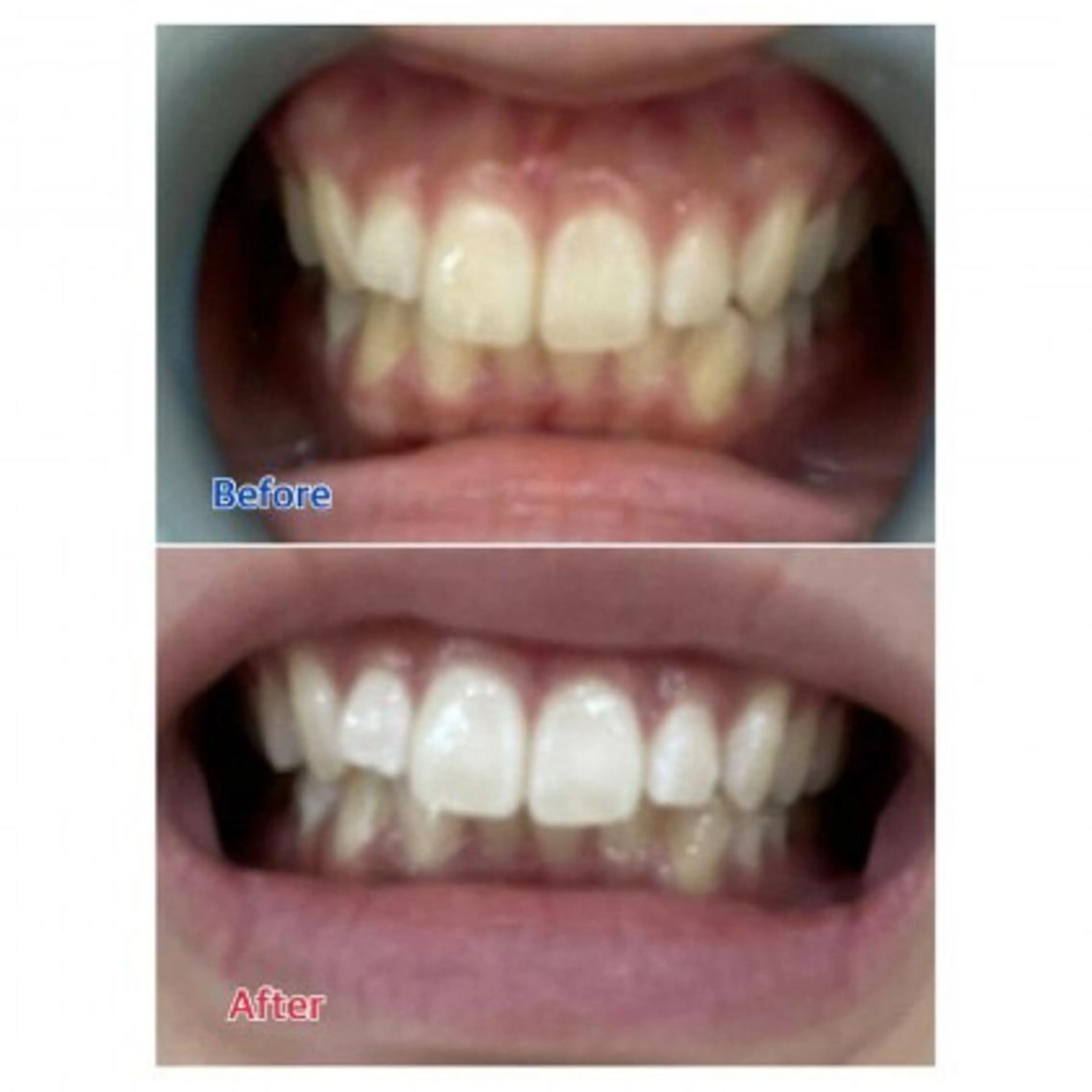 M渋谷店所属・Ｍ渋谷 ホワイトニングのエステ・リラクイメージ