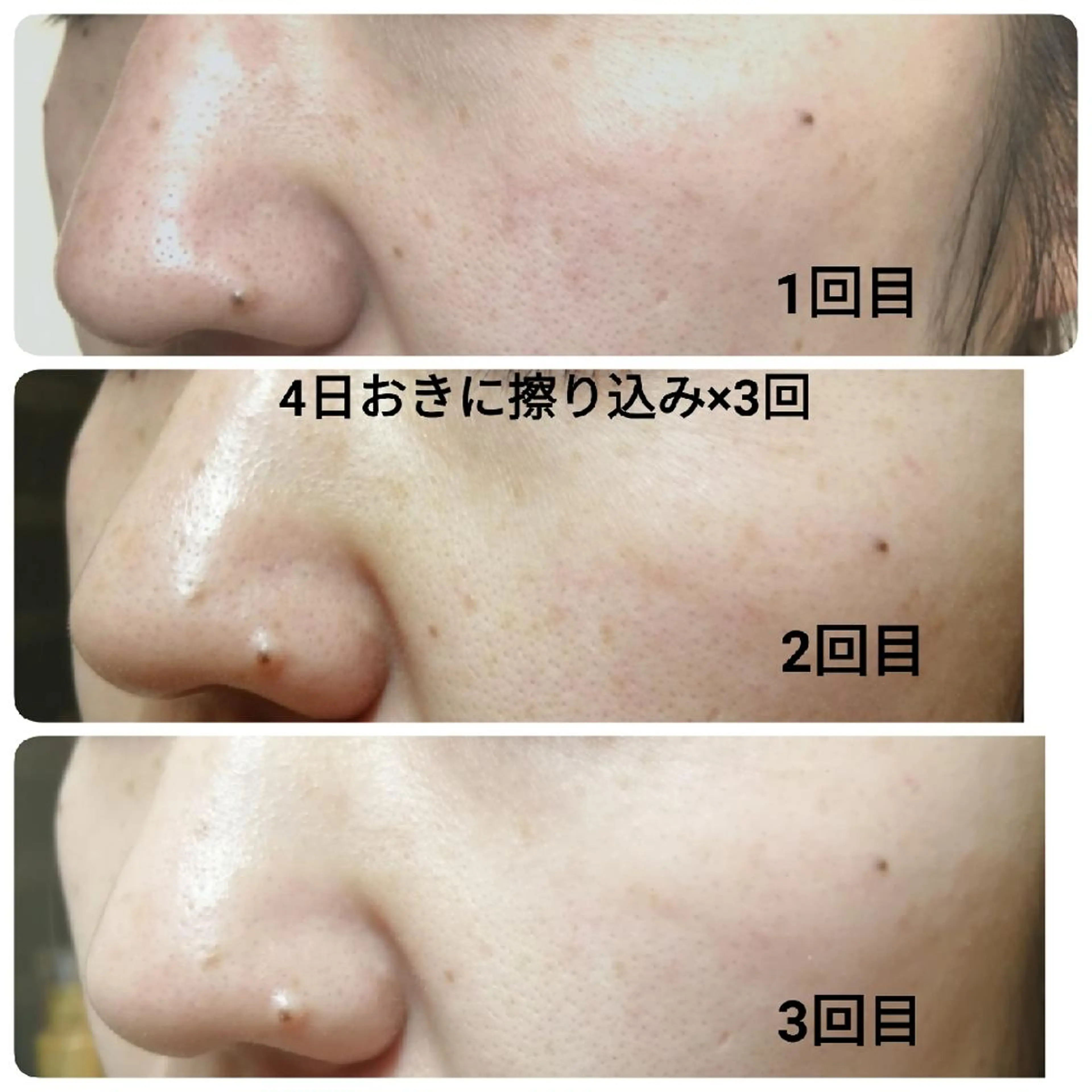 未病ケアサロン EMINY所属・未病ケアサロン EMINY☺︎勝俣のエステ・リラクイメージ