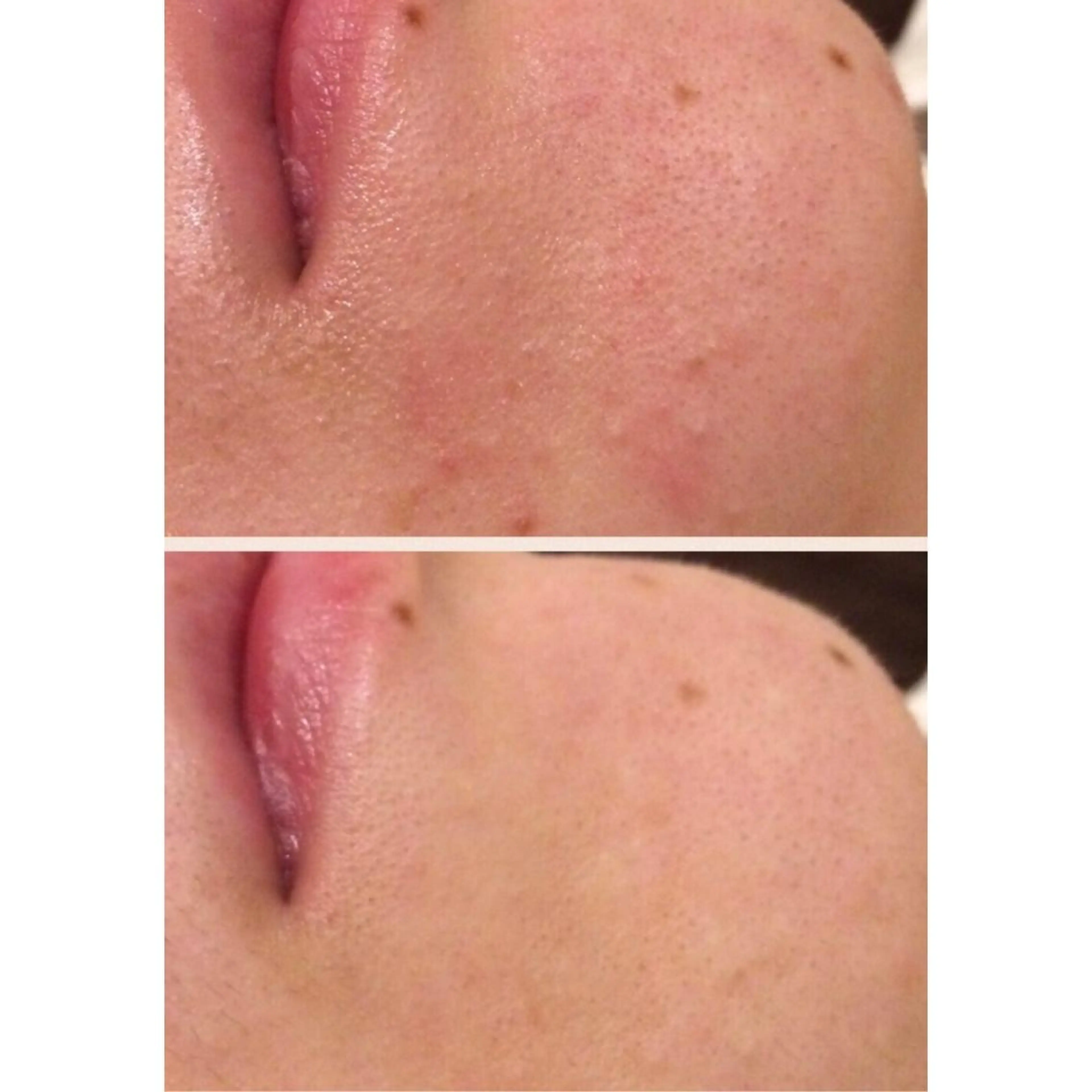 メンズ 四つ星サロン🎖 腸＆ニキビケアに特化のエステ・リラクイメージ