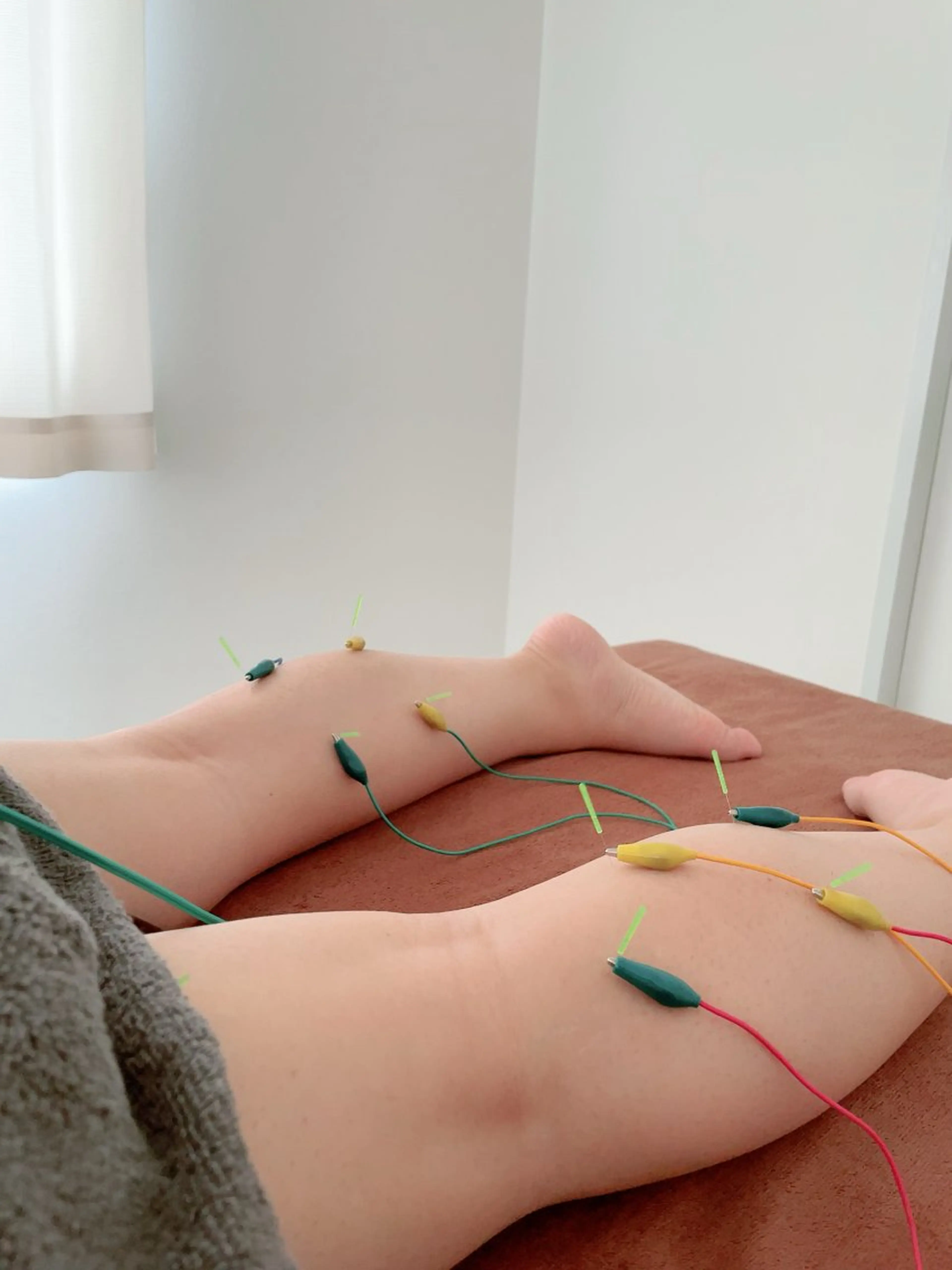 美容鍼＆鍼灸サロン 鍼Glitter.所属・田中 美奈のエステ・リラクイメージ