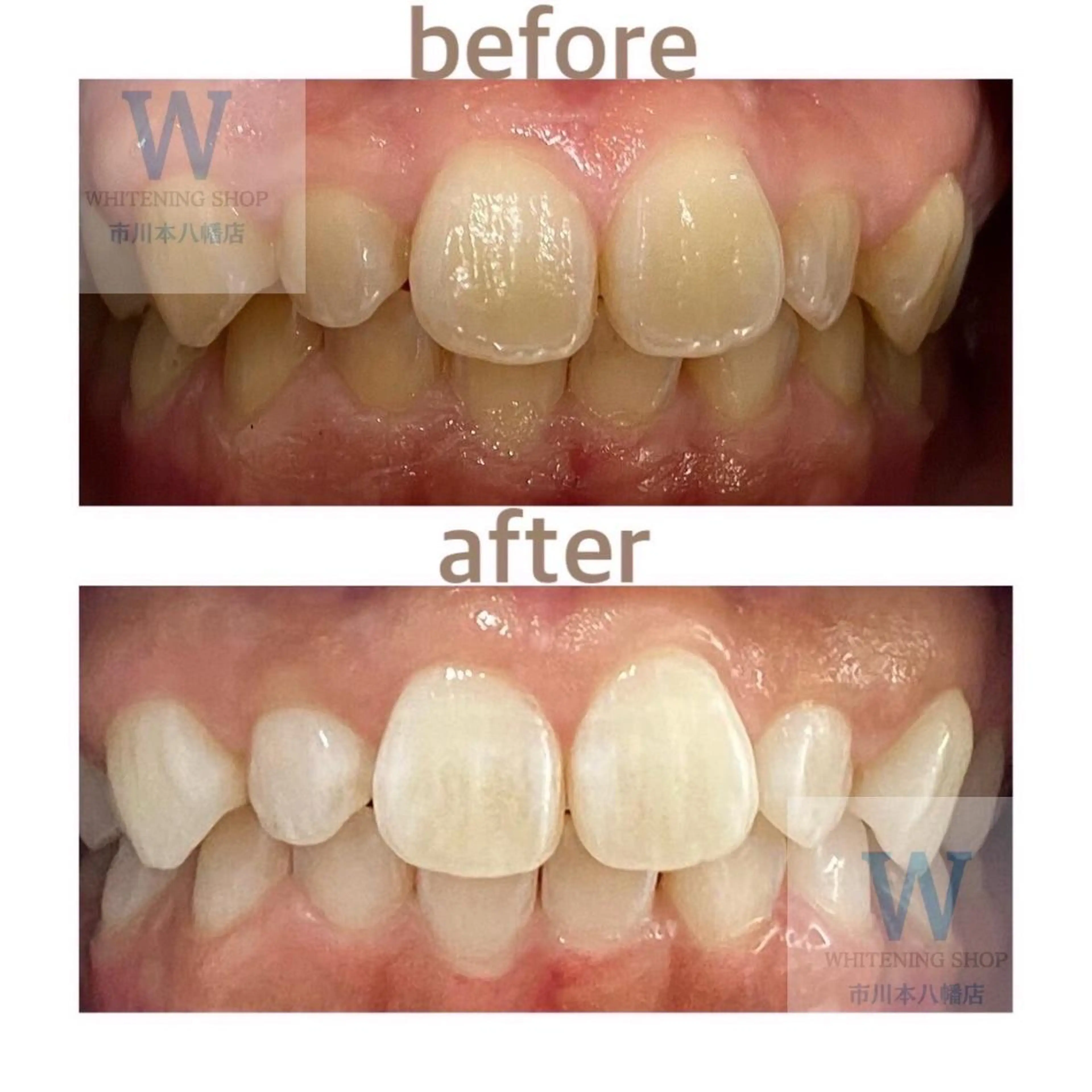 ホワイトニング ショップ本八幡店のエステ・リラクイメージ