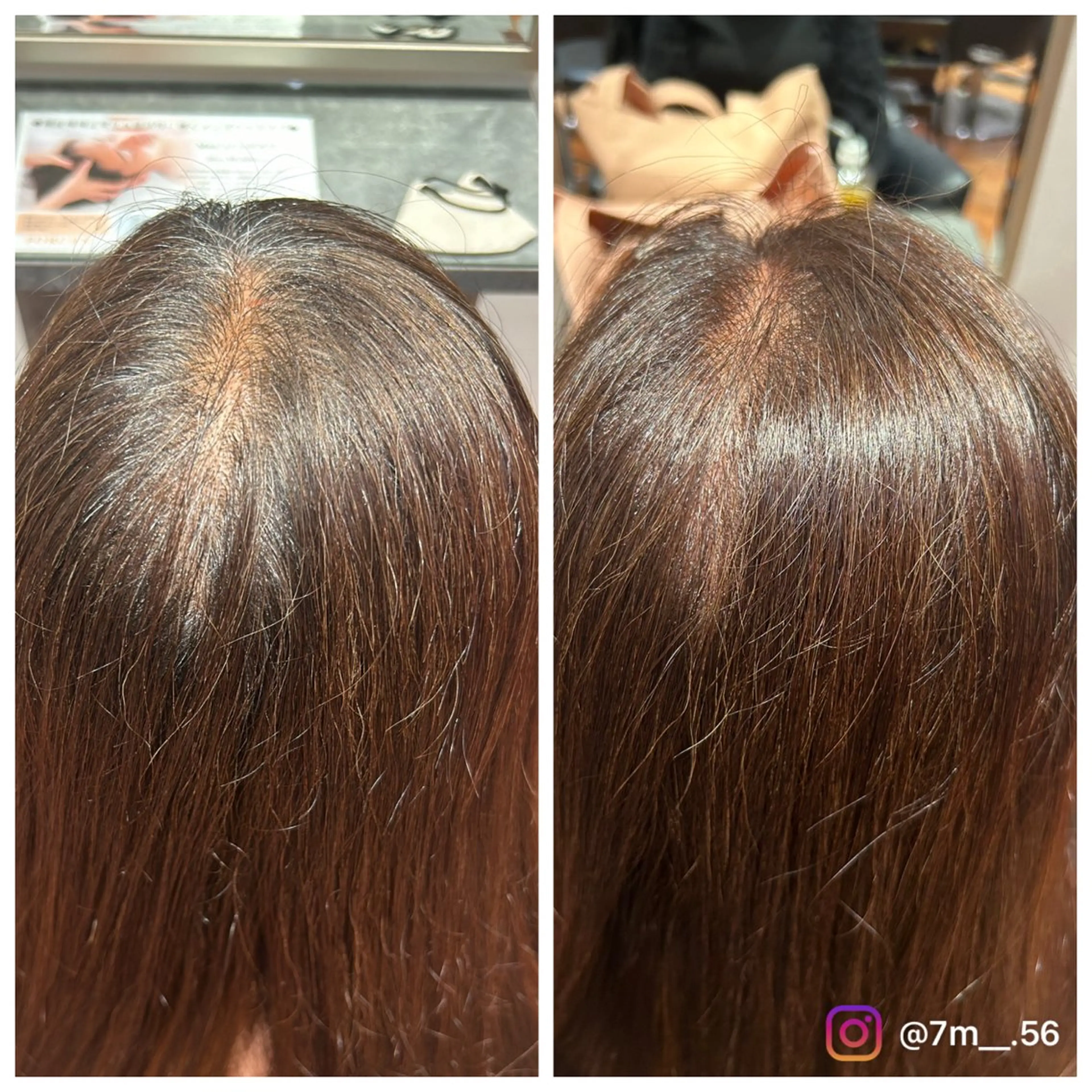 【平日限定】白髪染め（アルカリカラー）💆🏻‍♀️🌟の写真