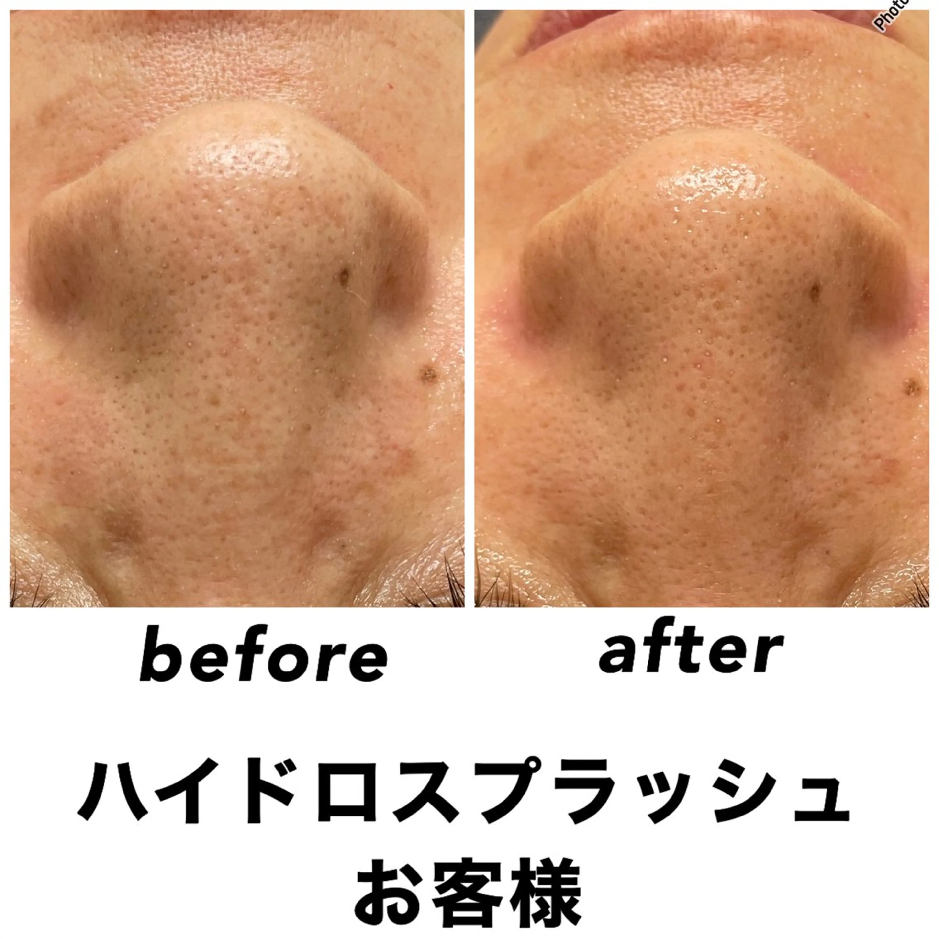 エステ リラク ネイル・エステサロンUILANI所属・ネイル・エステサロン UILANIのネイルデザイン