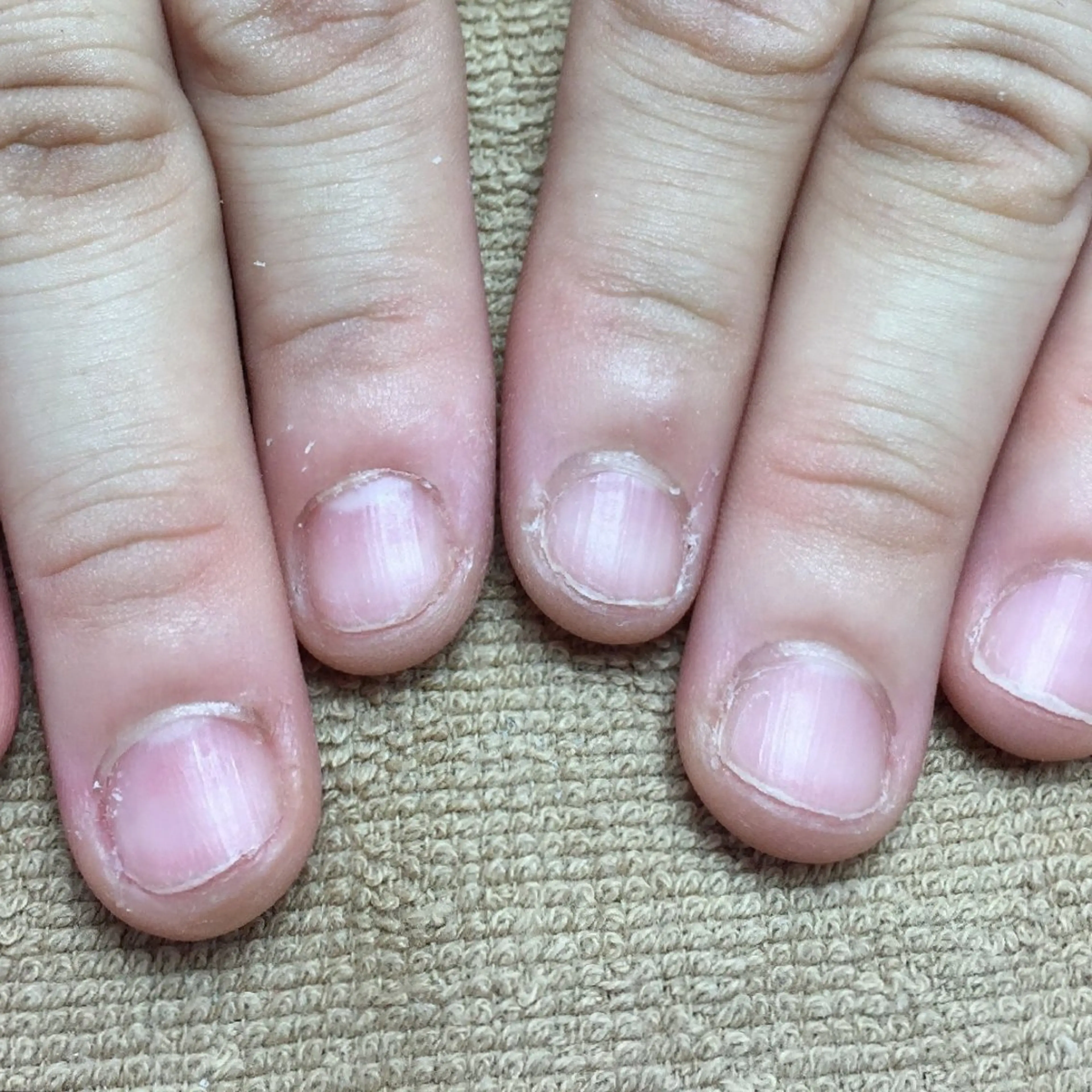 ネイル ハンドネイル ハンドケア 深爪矯正/爪育成ケア manie nailのネイルデザイン