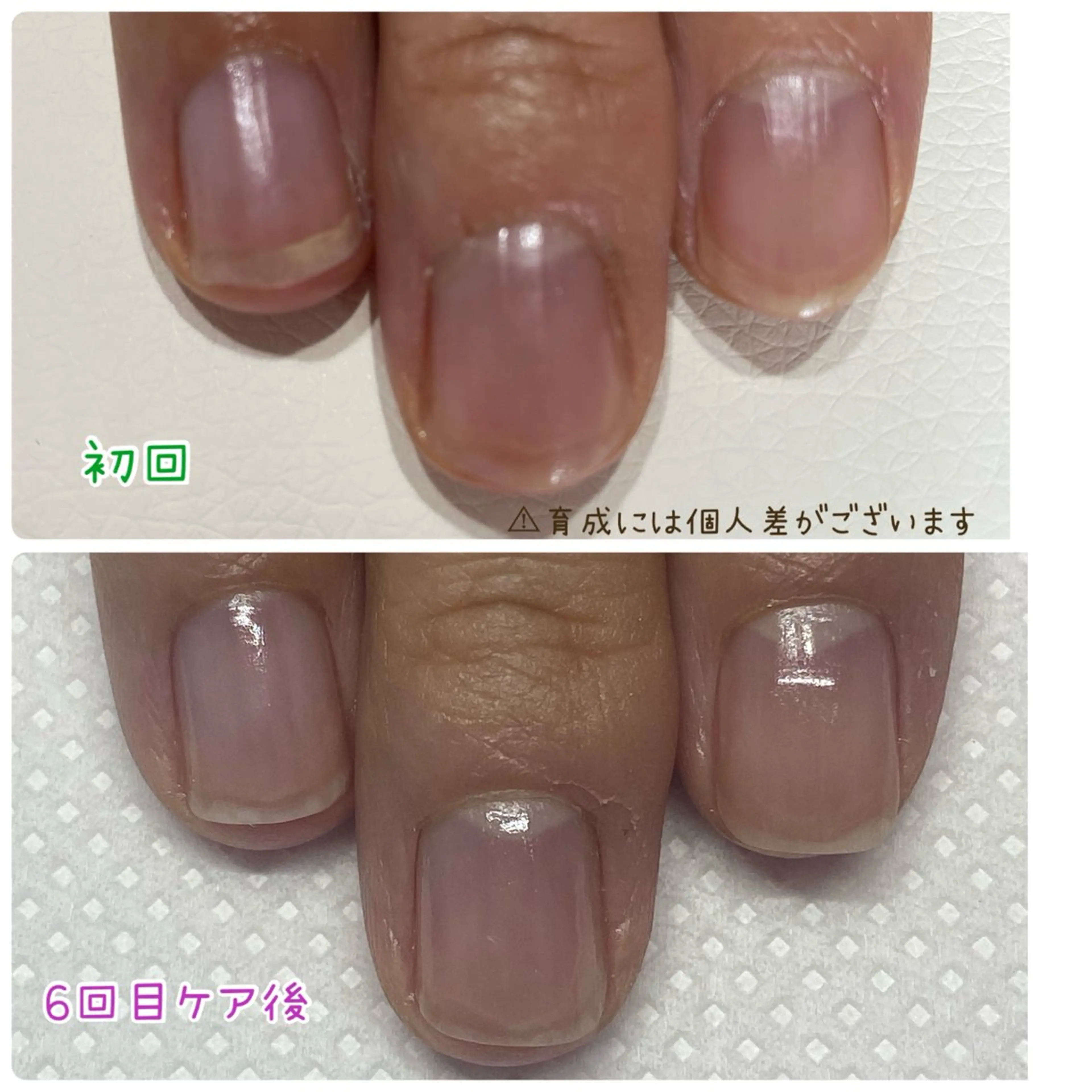 ネイル その他(ネイル) Ella nailsalon所属・Ella nail ちゆうのネイルデザイン