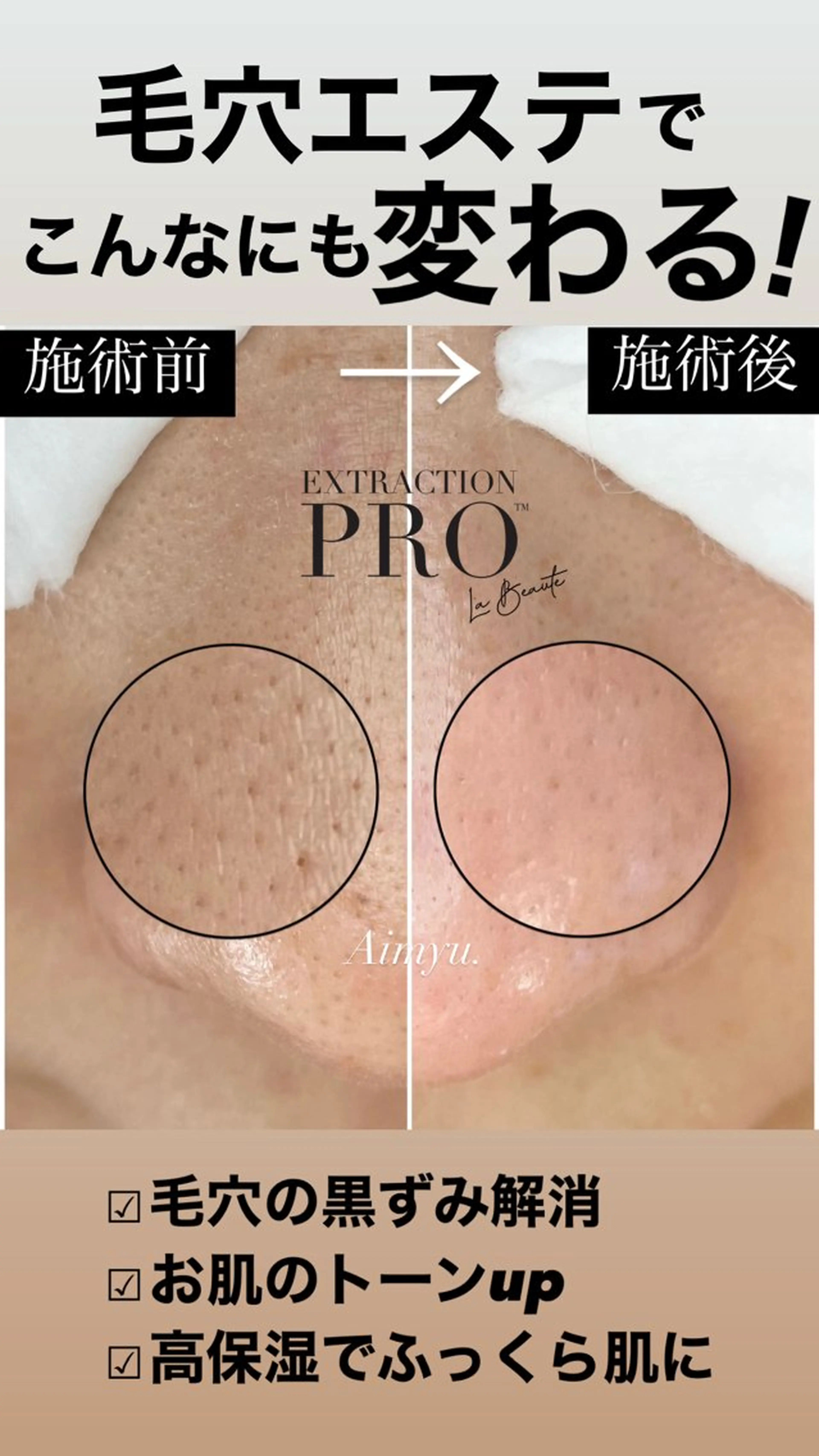 1年の感謝を込めて✨️毛穴の大掃除+癒しのデコルテマッサージを特別価格で🎁【毛穴改善コース】🫧 90分の写真