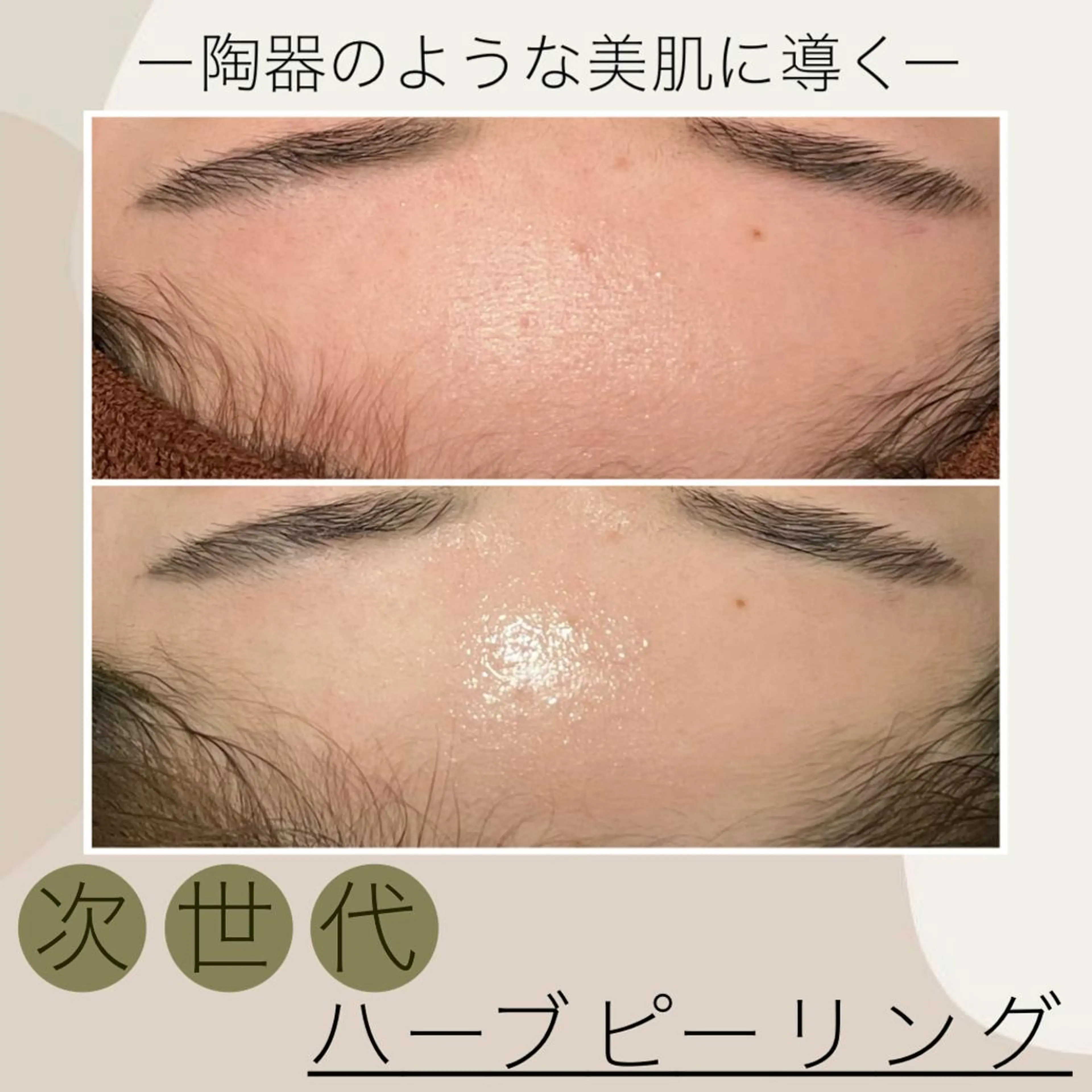 エステ Meow！～トラブル肌専門ピーリング＆脱毛サロン～所属・トラブル肌改善🏥 Meow！🫧🫧のその他イメージ