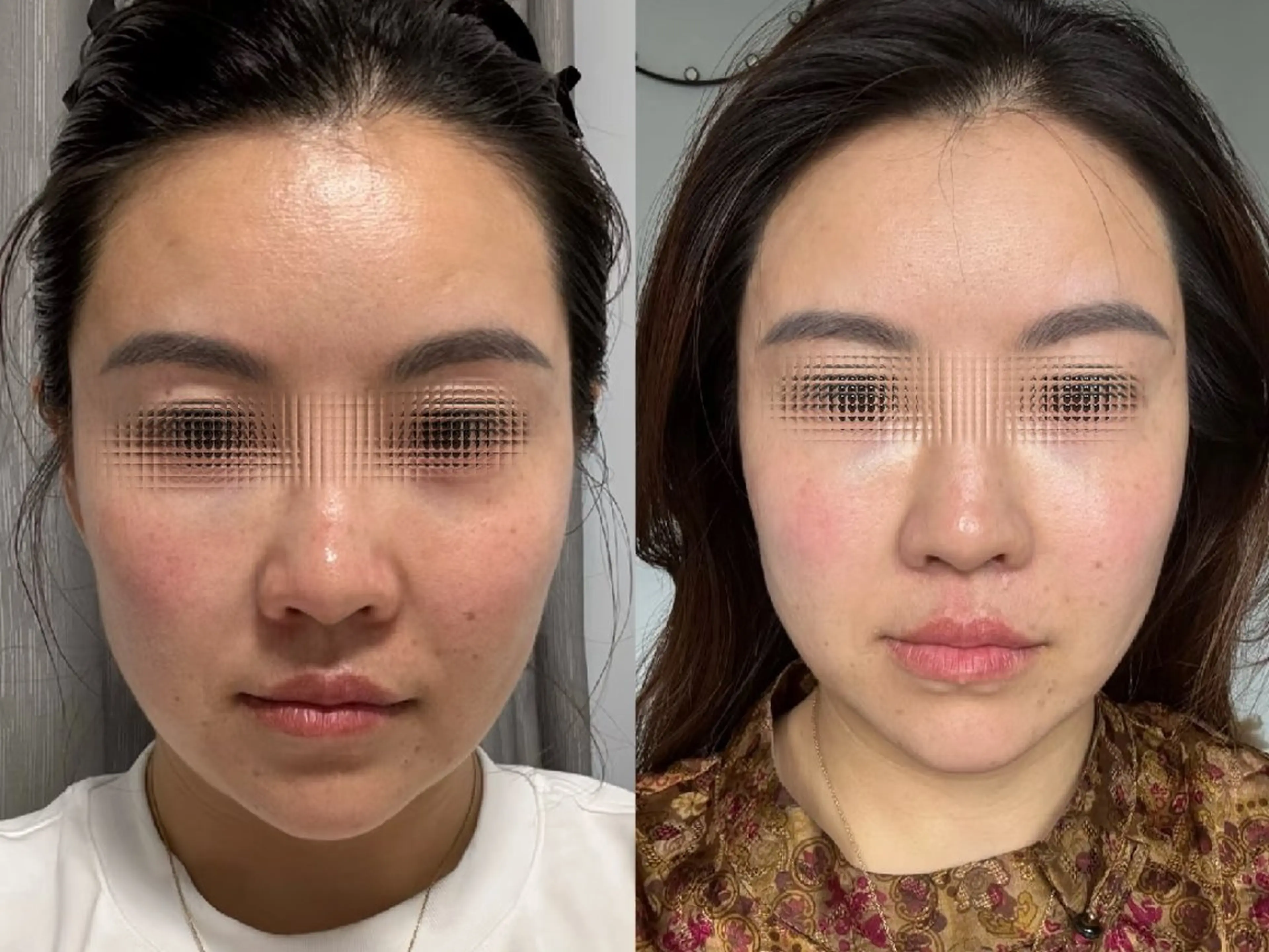 エステ aliaハイフ&水光ジェットサロン所属・aliaハーブ水光店 エステティシャン募集のエステ・リラクイメージ