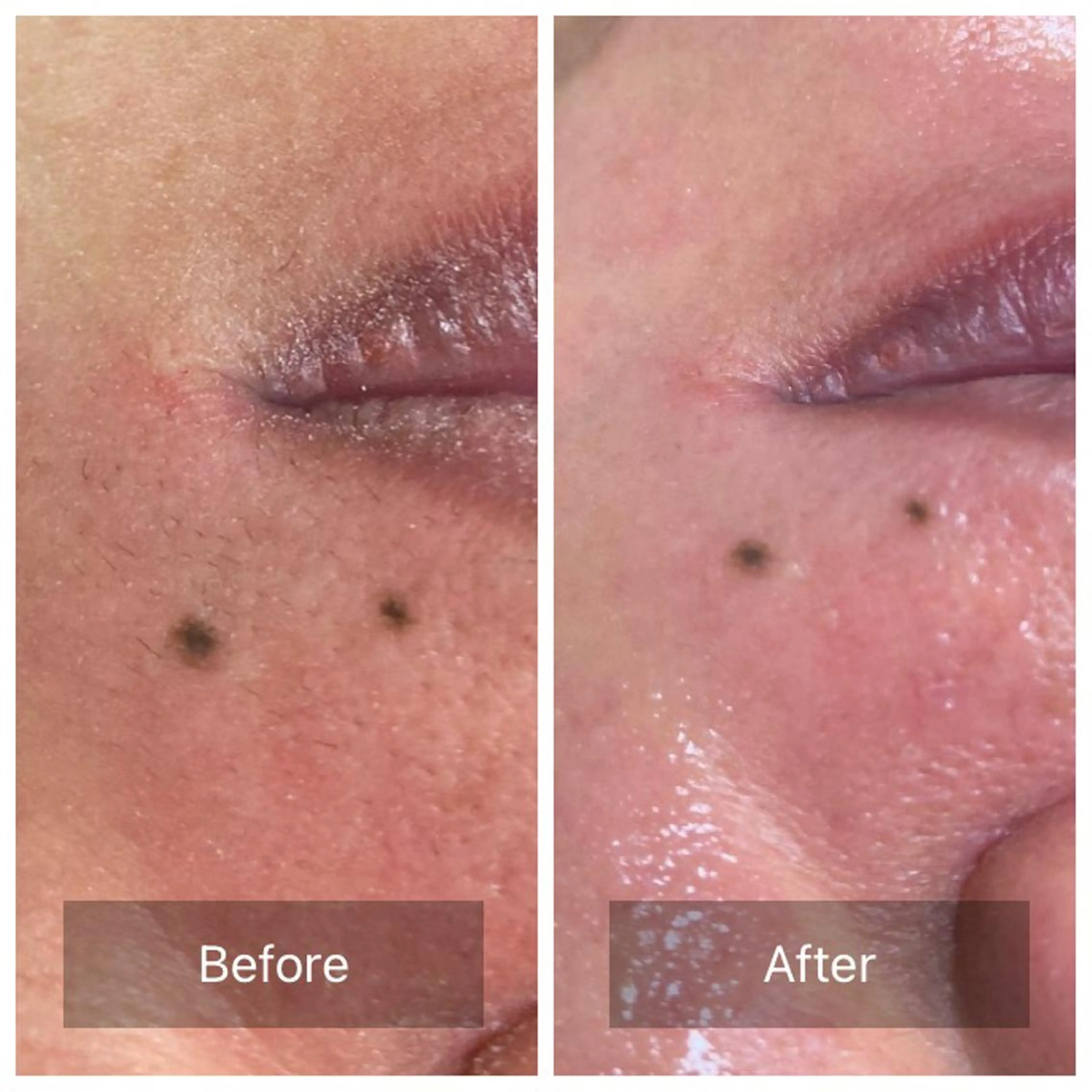 エステ 産毛専門店 Bittoのエステ・リラクイメージ