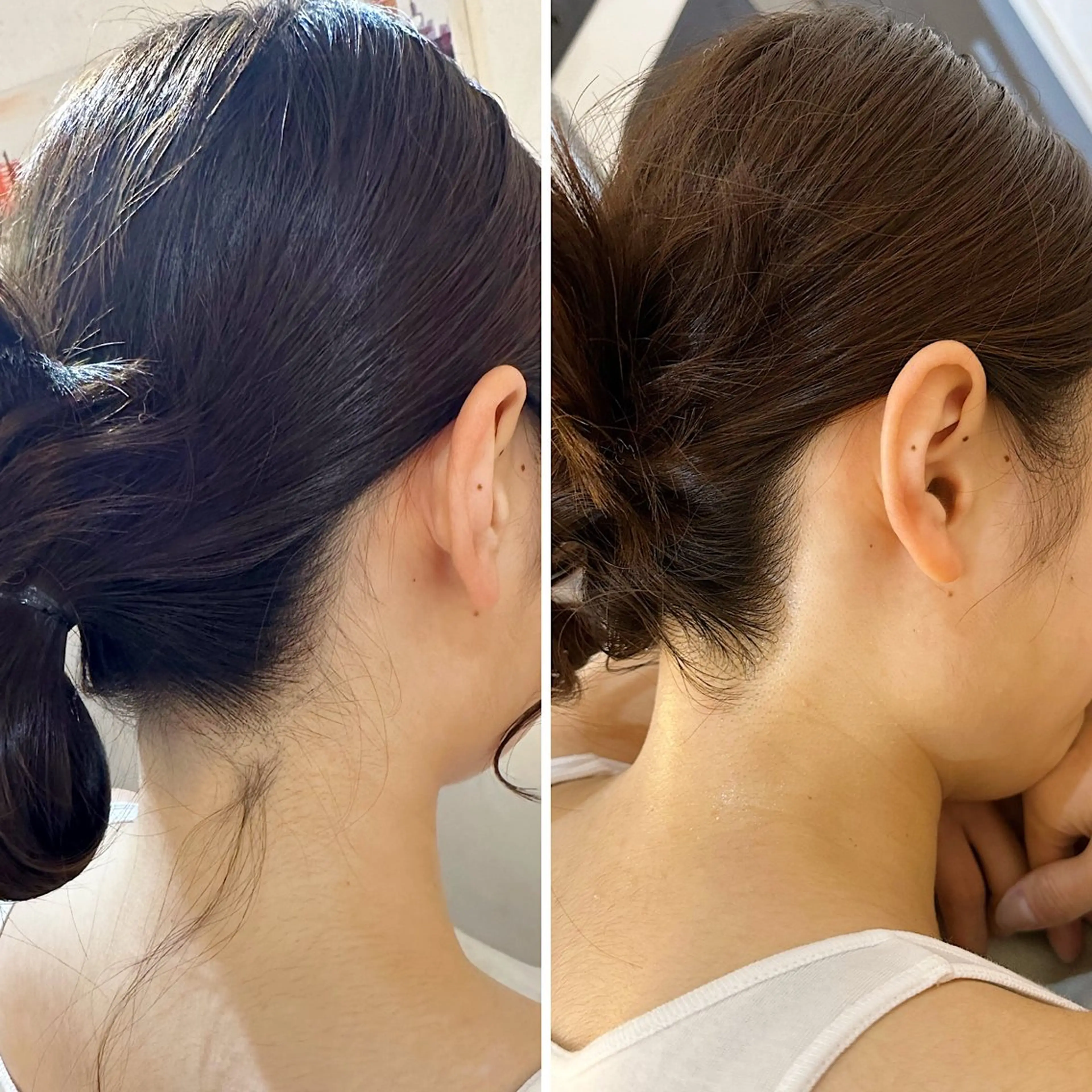 脱毛 うなじ脱毛/美肌脱毛 LABELのエステ・リラクイメージ