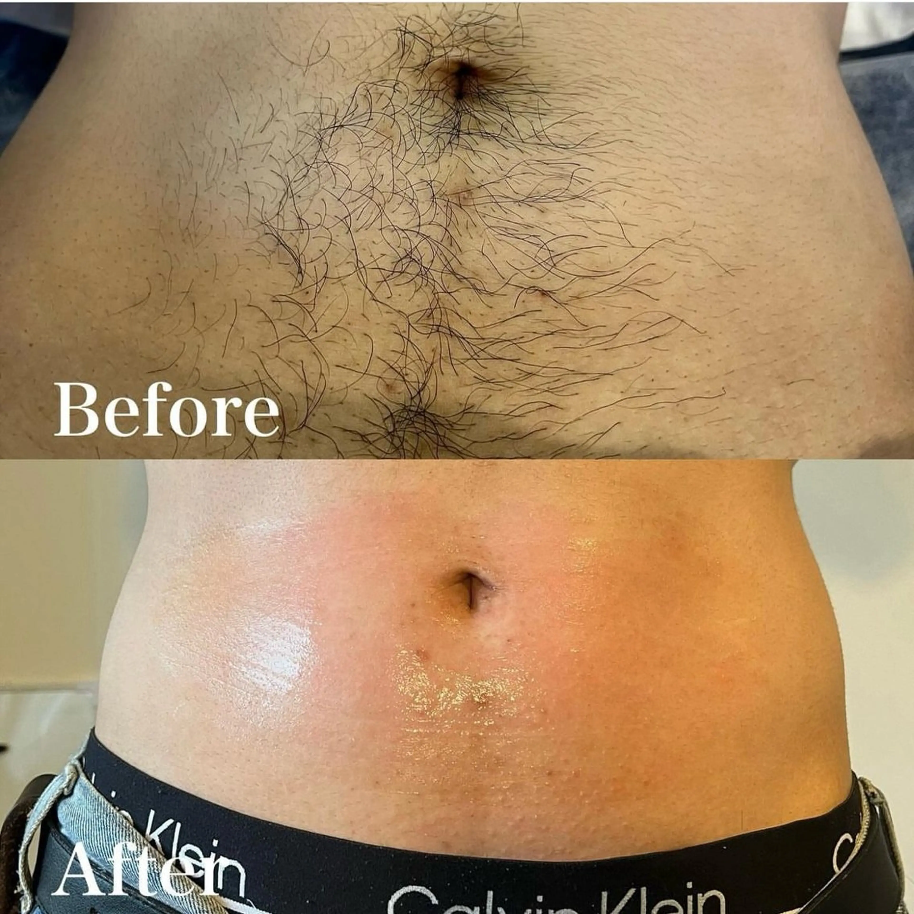 メンズ 脱毛 wax脱毛専門店 ハイラントのエステ・リラクイメージ