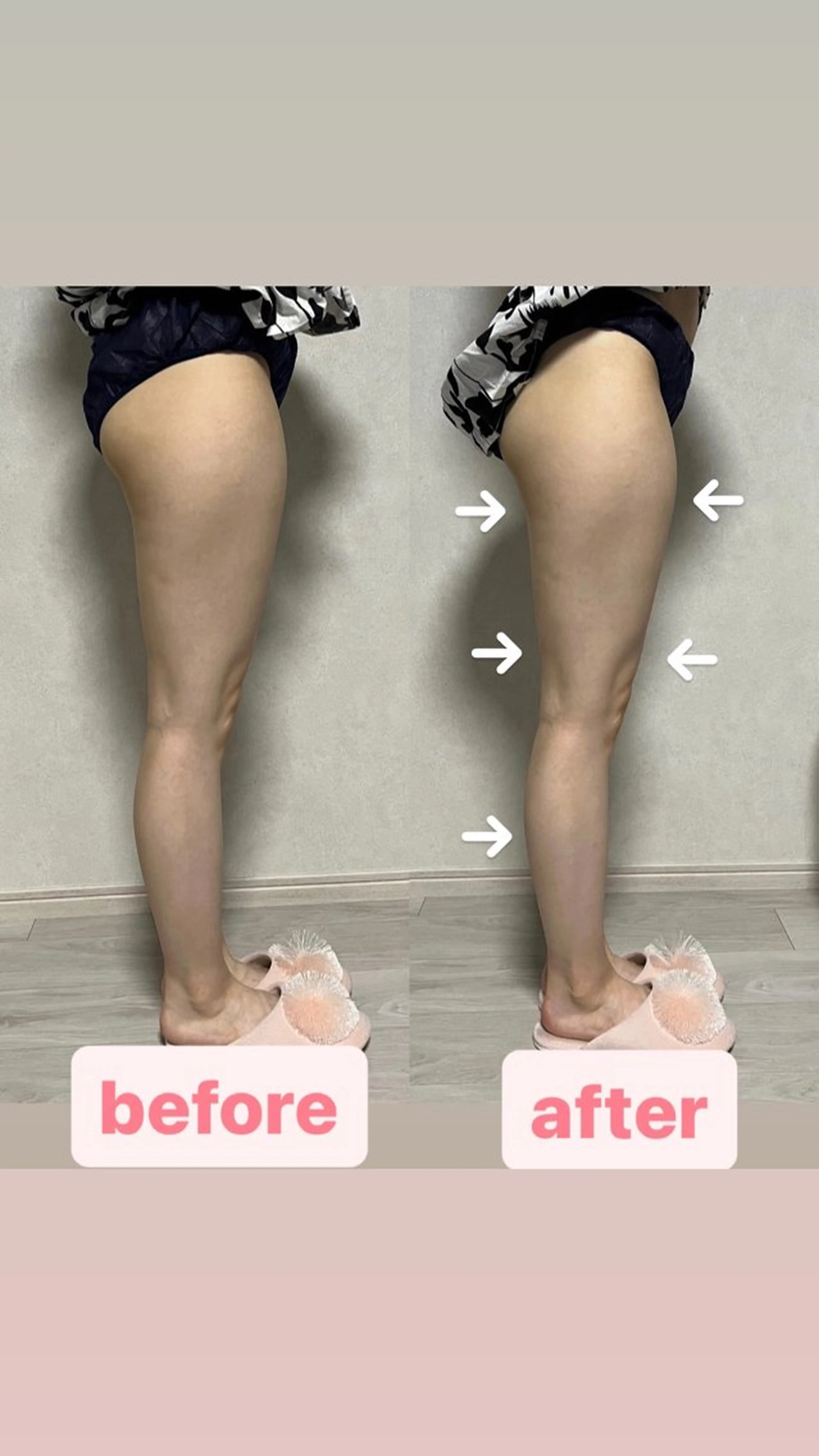 salon de blue rose所属・ハイパーナイフ専門 熊田陽子のエステ・リラクイメージ