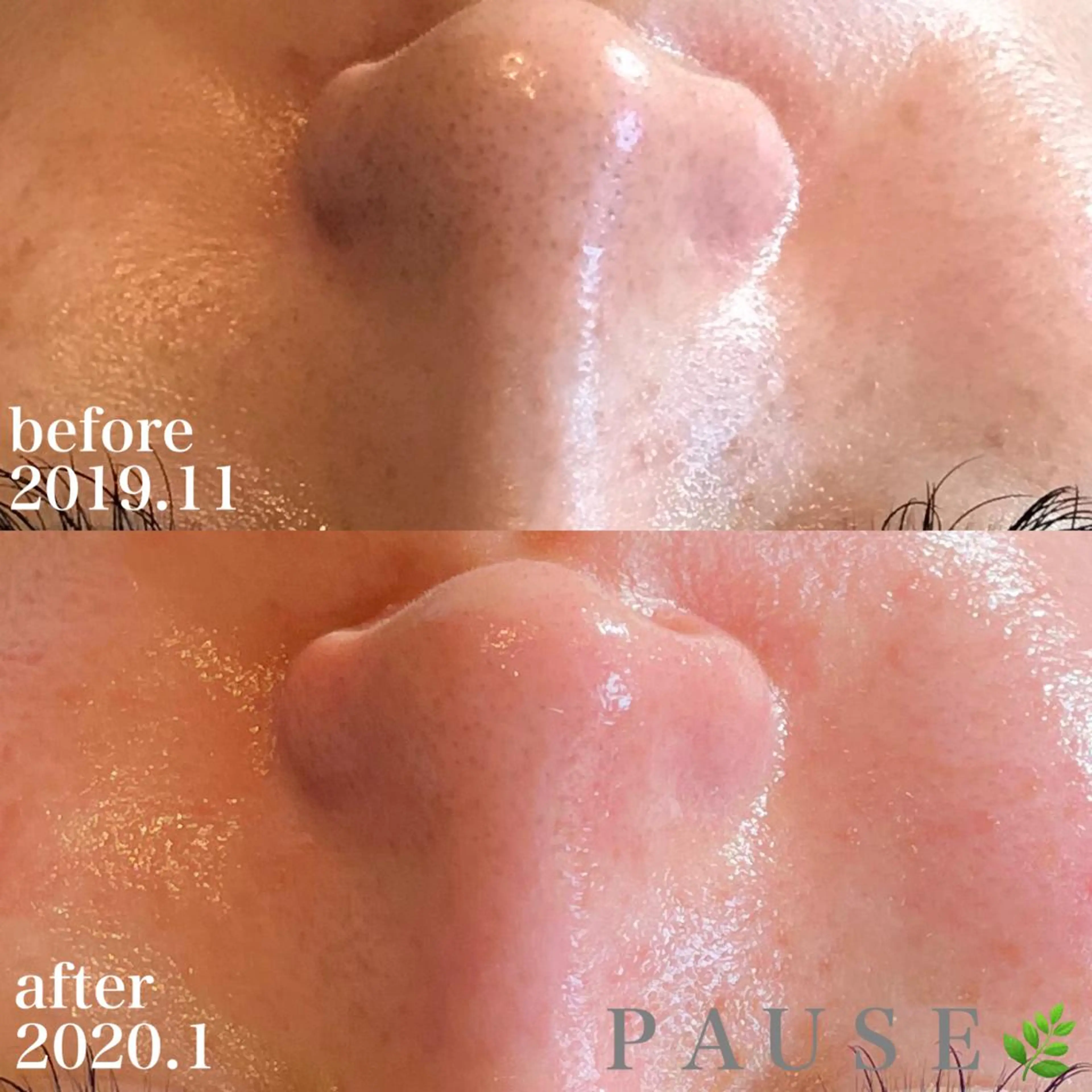 エステ 浜野 恵美のエステ・リラクイメージ