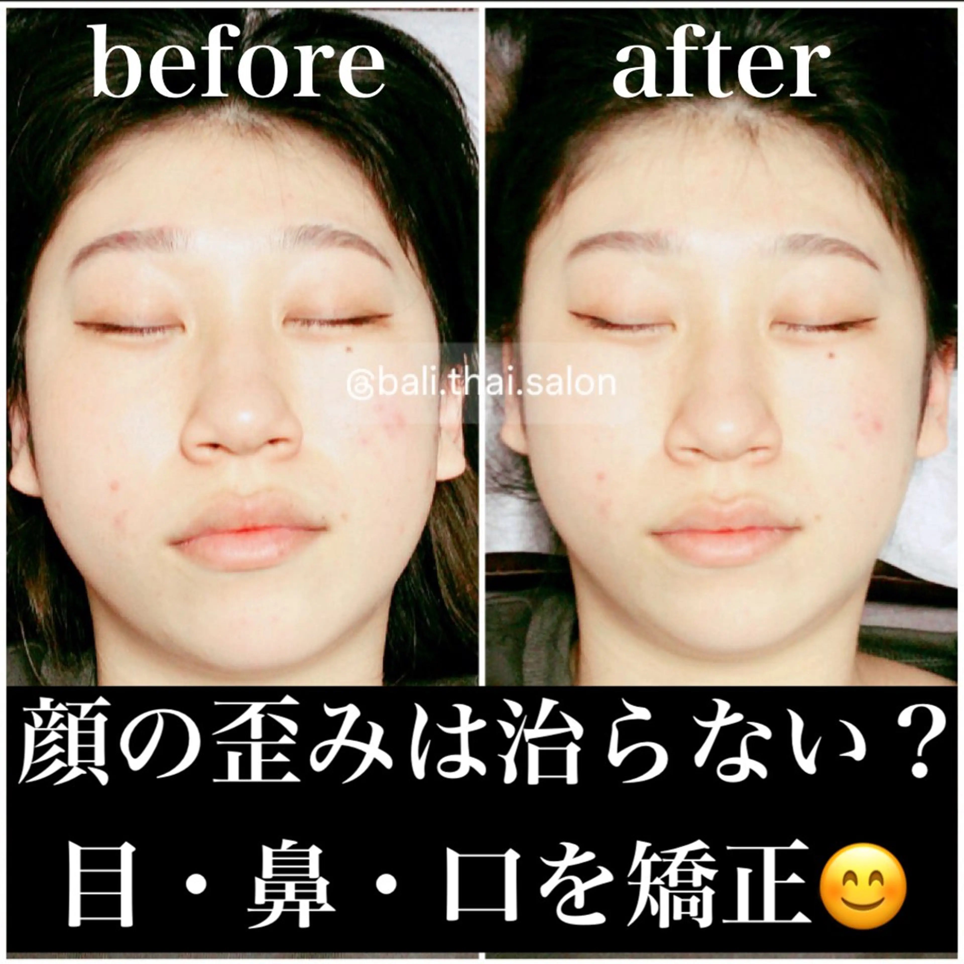 🌈歪み改善🌈 バリンタイ すぎうらのエステ・リラクイメージ