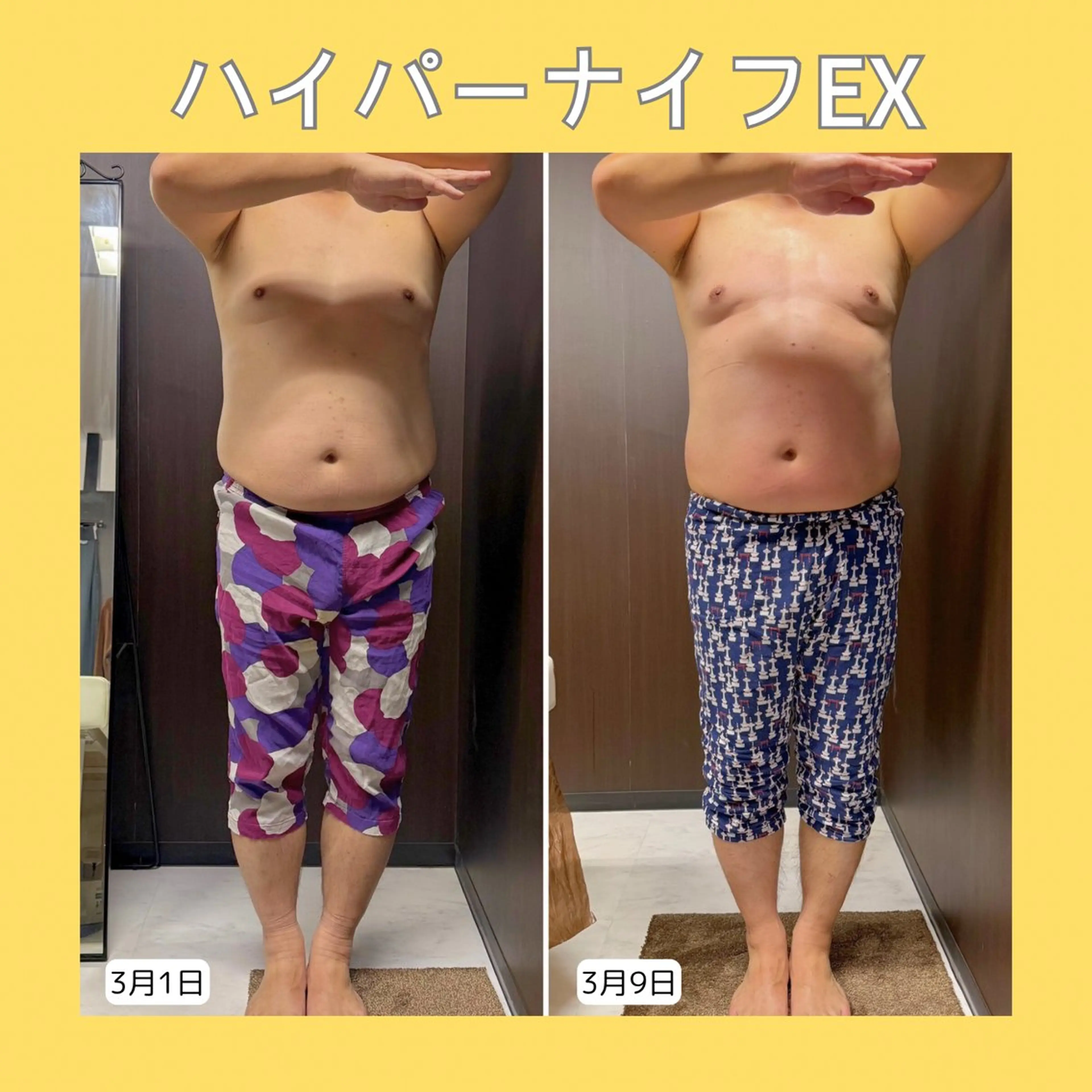 エステ 赤澤/本気痩せ・脱毛 ・ノーファンデ肌のその他イメージ