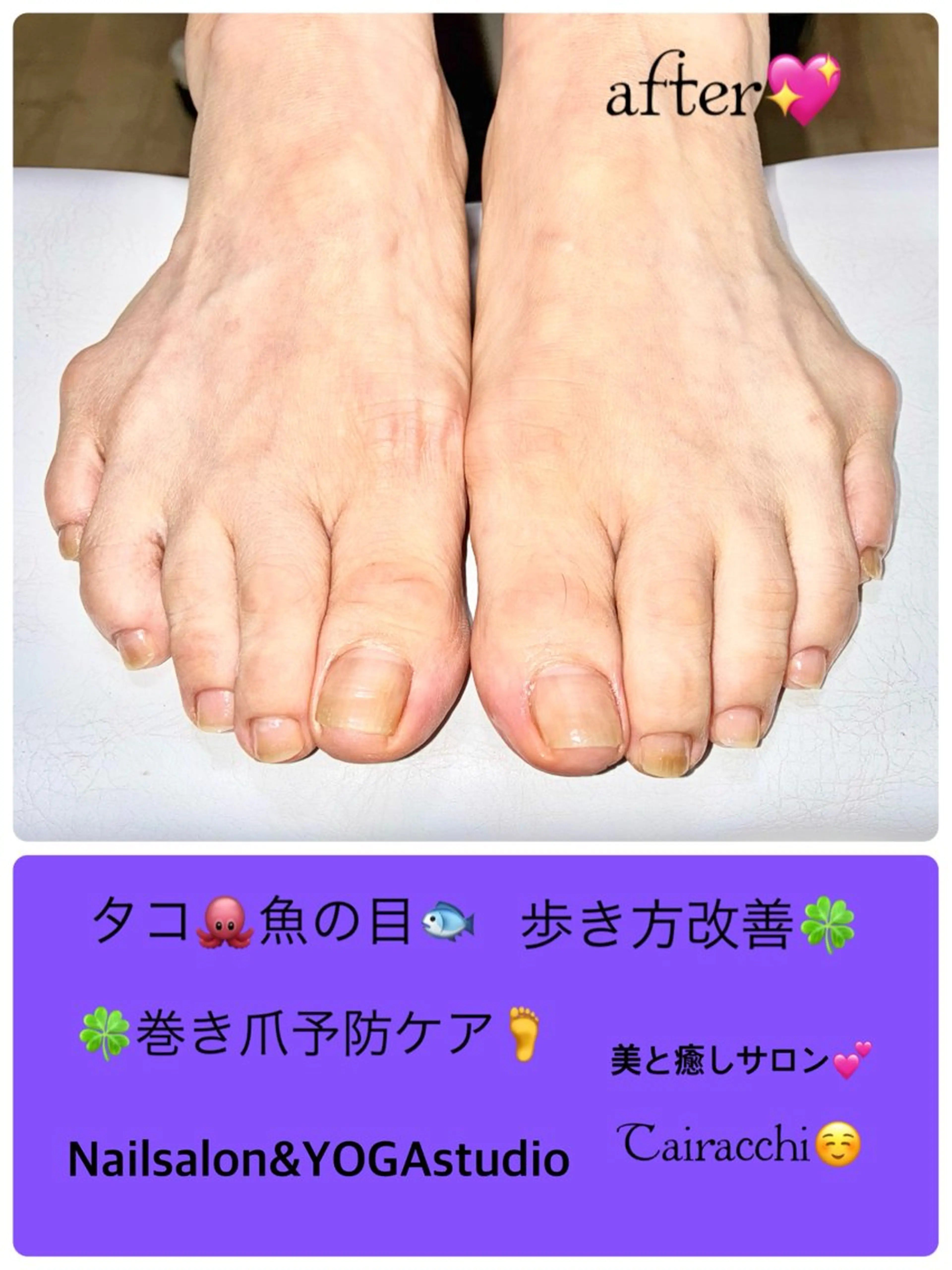 ネイル フットネイル Tairacchi ﾀｲﾗｯﾁのネイルデザイン