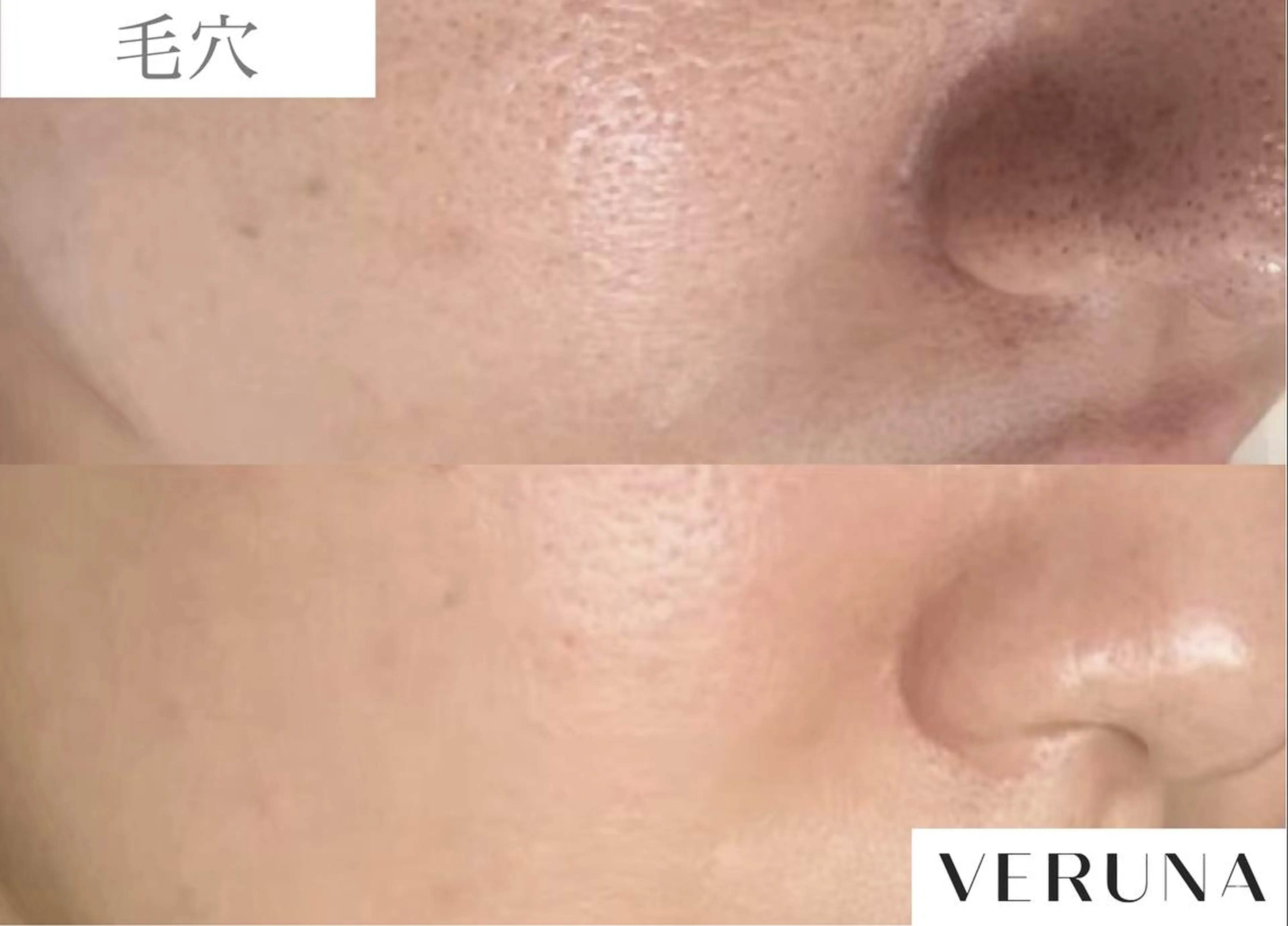 業界初の頭皮ケア 棘スカルプLUNEAのヘアスタイル