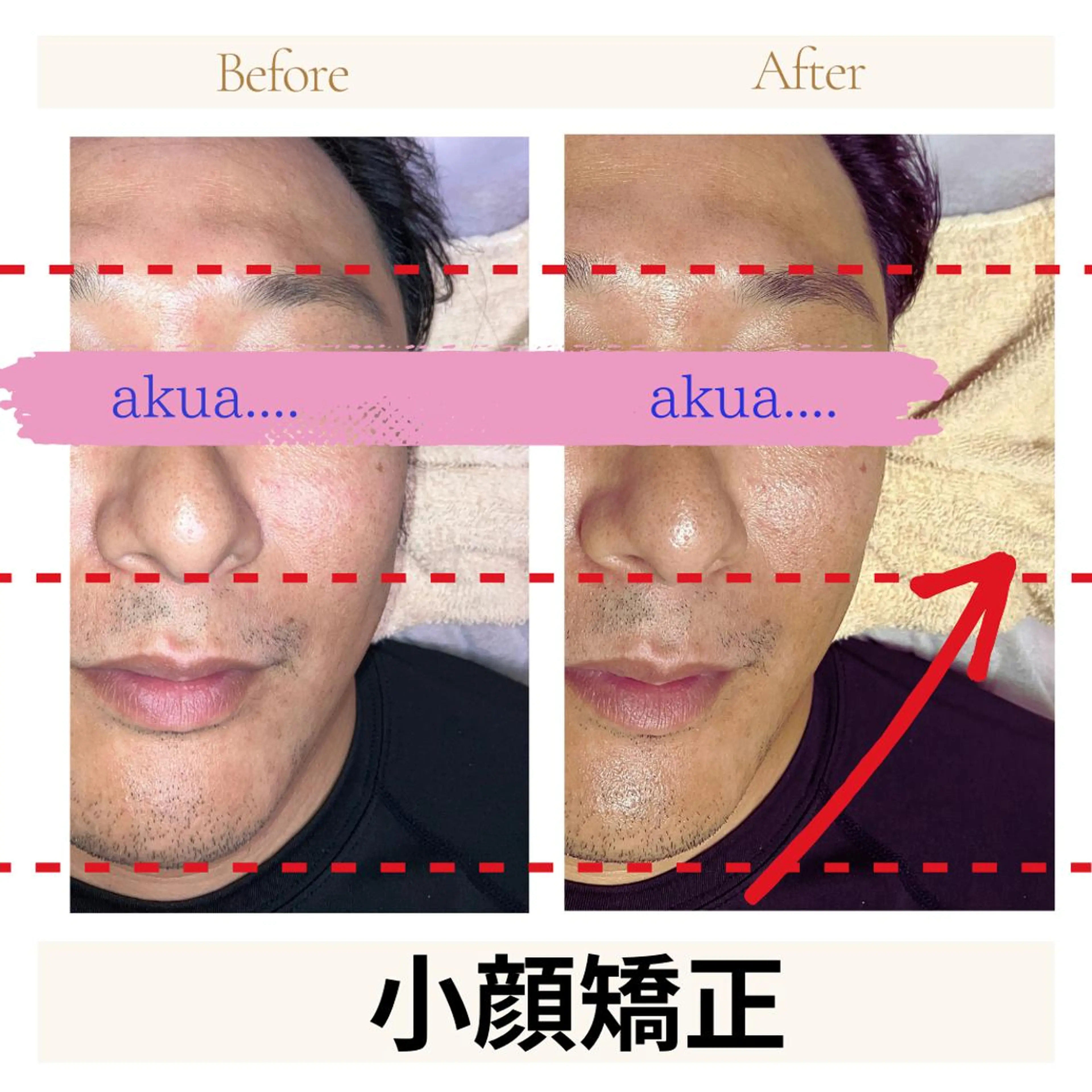 akua... 【肌質管理専門】のその他イメージ