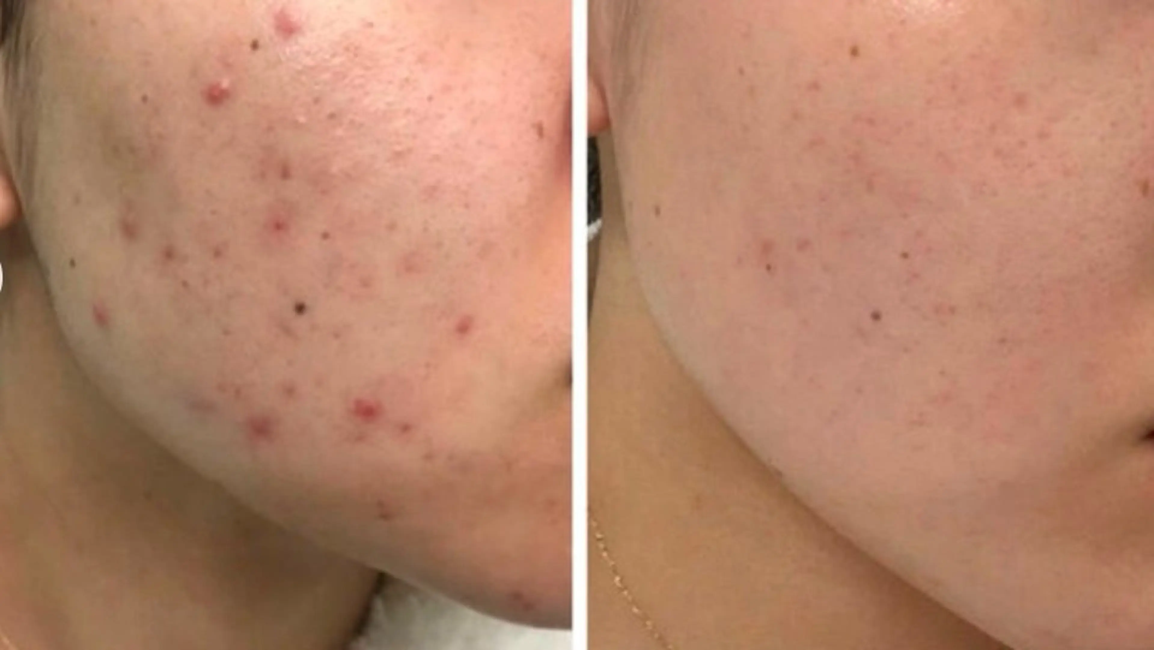 その他 耳ツボ/体質改善/ 温活La mer月島のその他イメージ