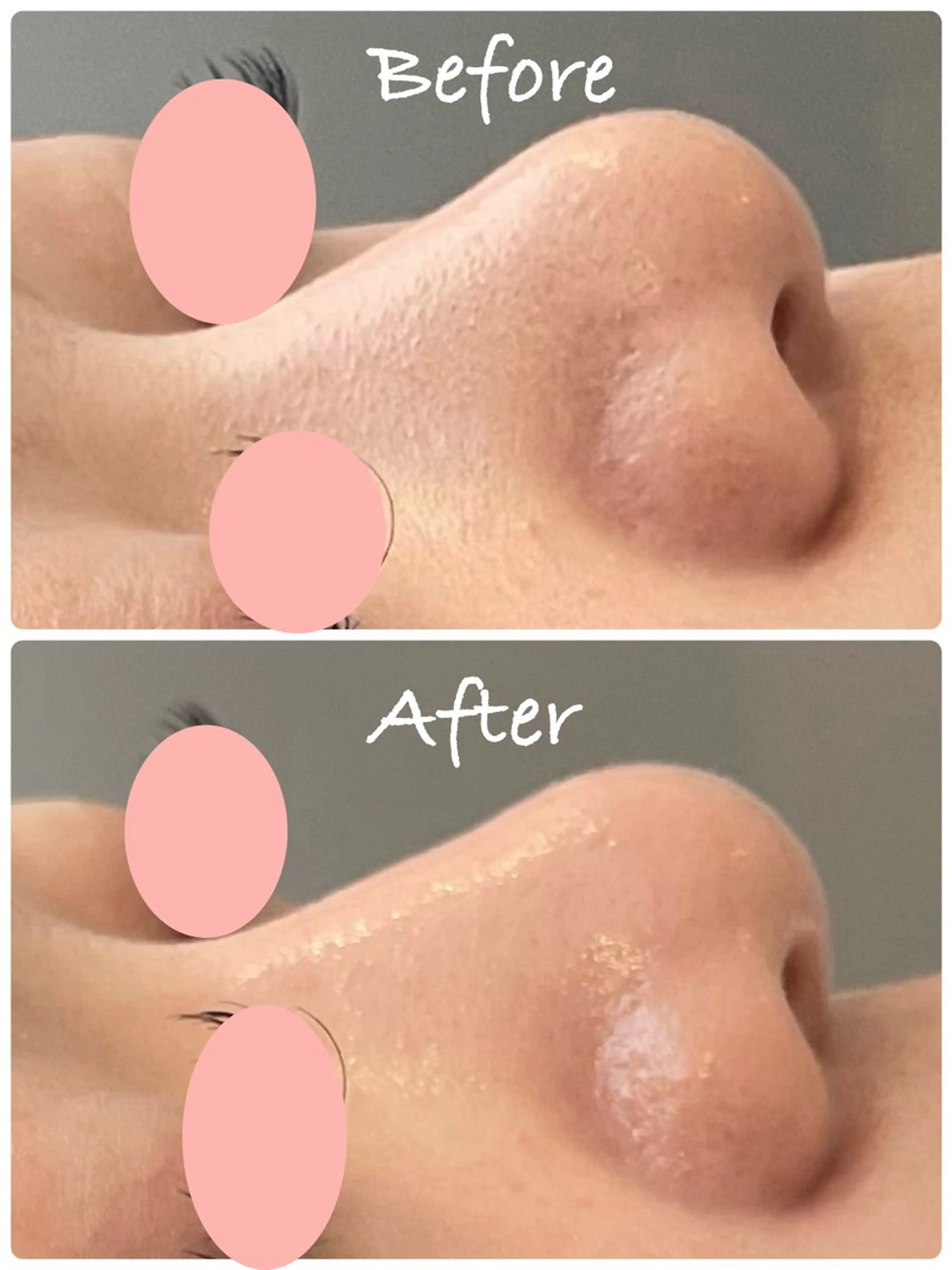 肌質改善ハーブピーリング専門Loy所属・Loy（ロイ）🍀 ハーブピーリング🌈のエステ・リラクイメージ