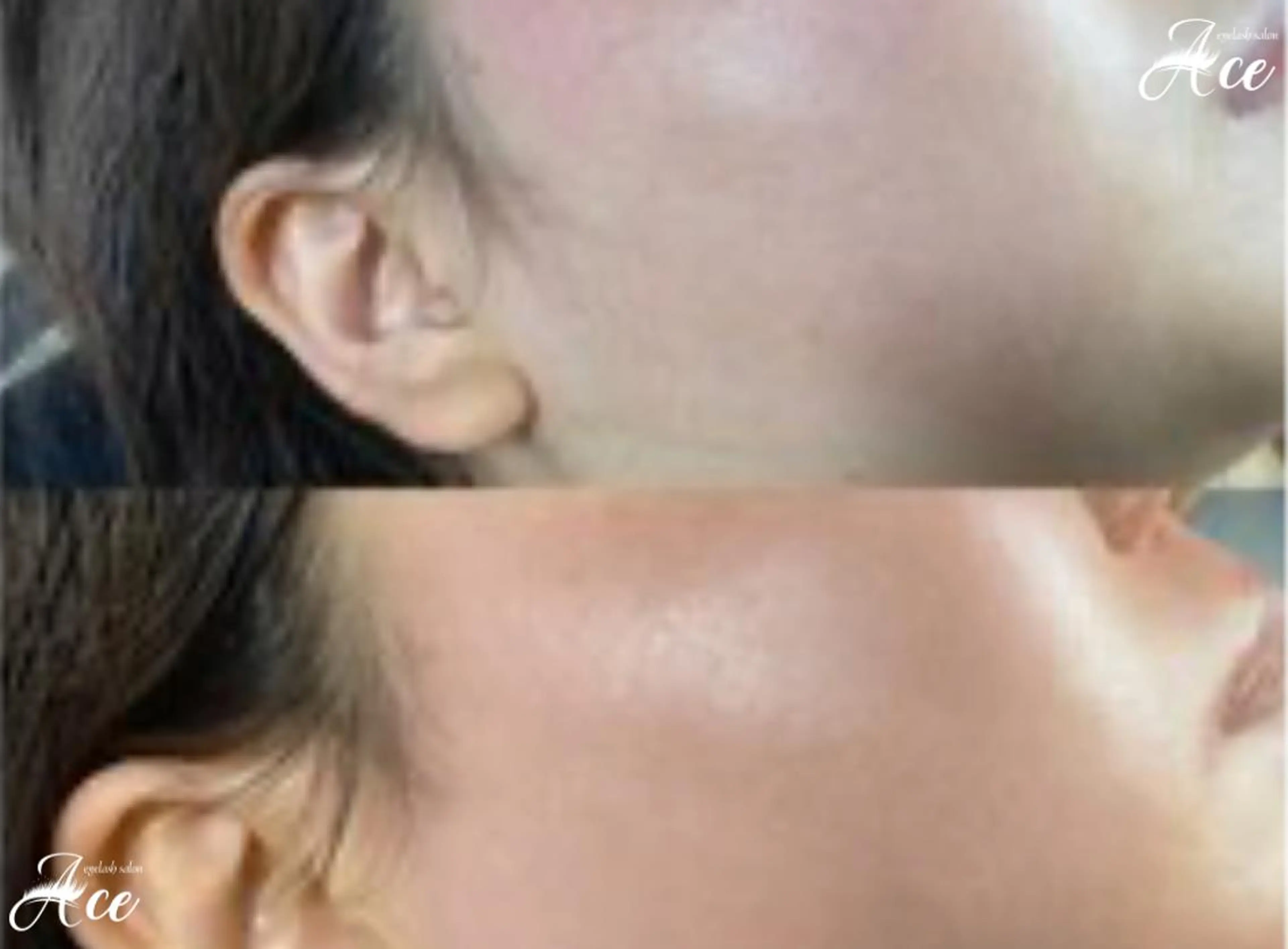 【透明感UP艶肌★】HBL発💋全顔Wax(鎮静パック付き) 5,980円[銀座・東銀座]の写真