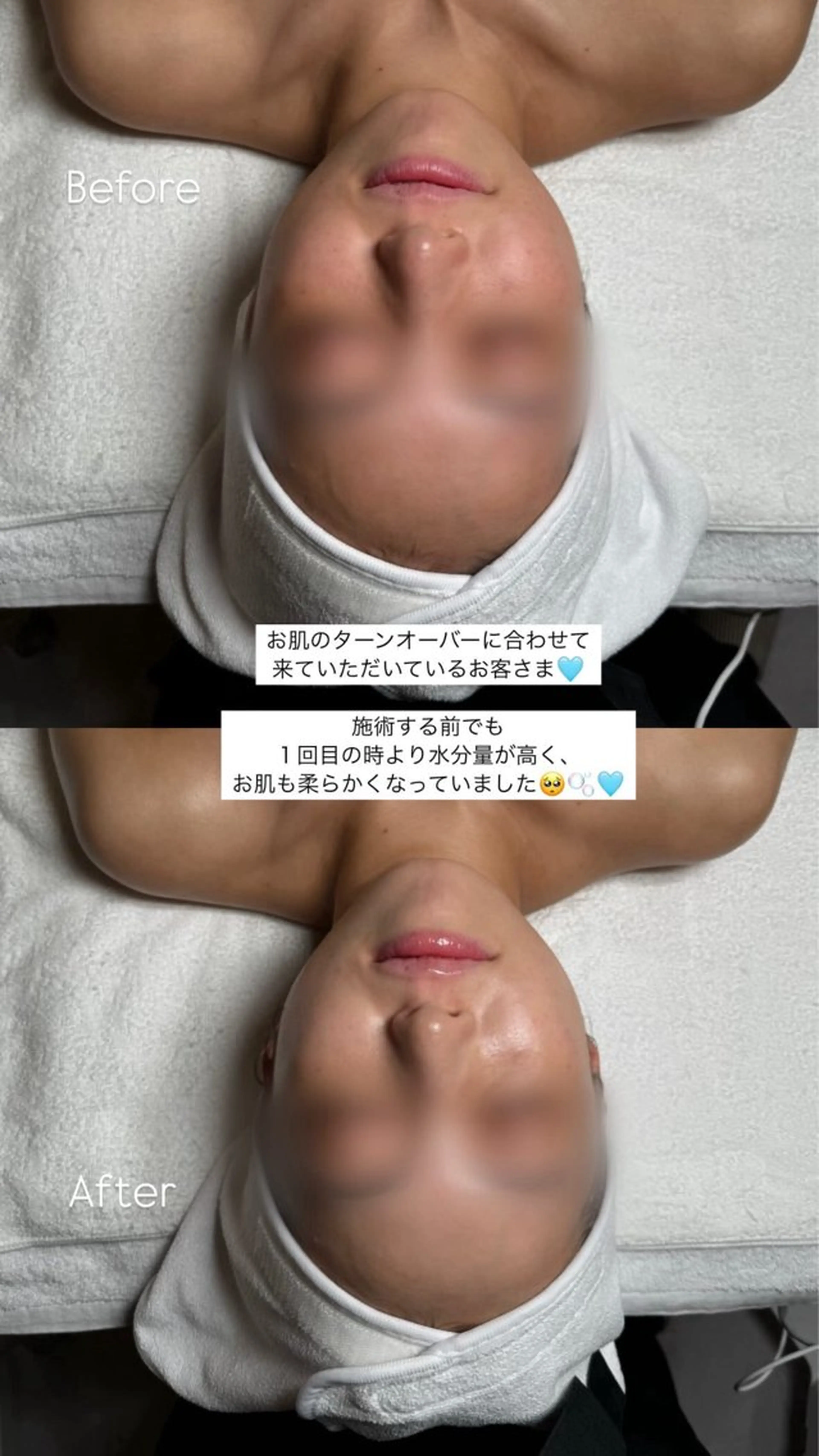 韓国肌管理🫧LDM 🫧Junnaのエステ・リラクイメージ