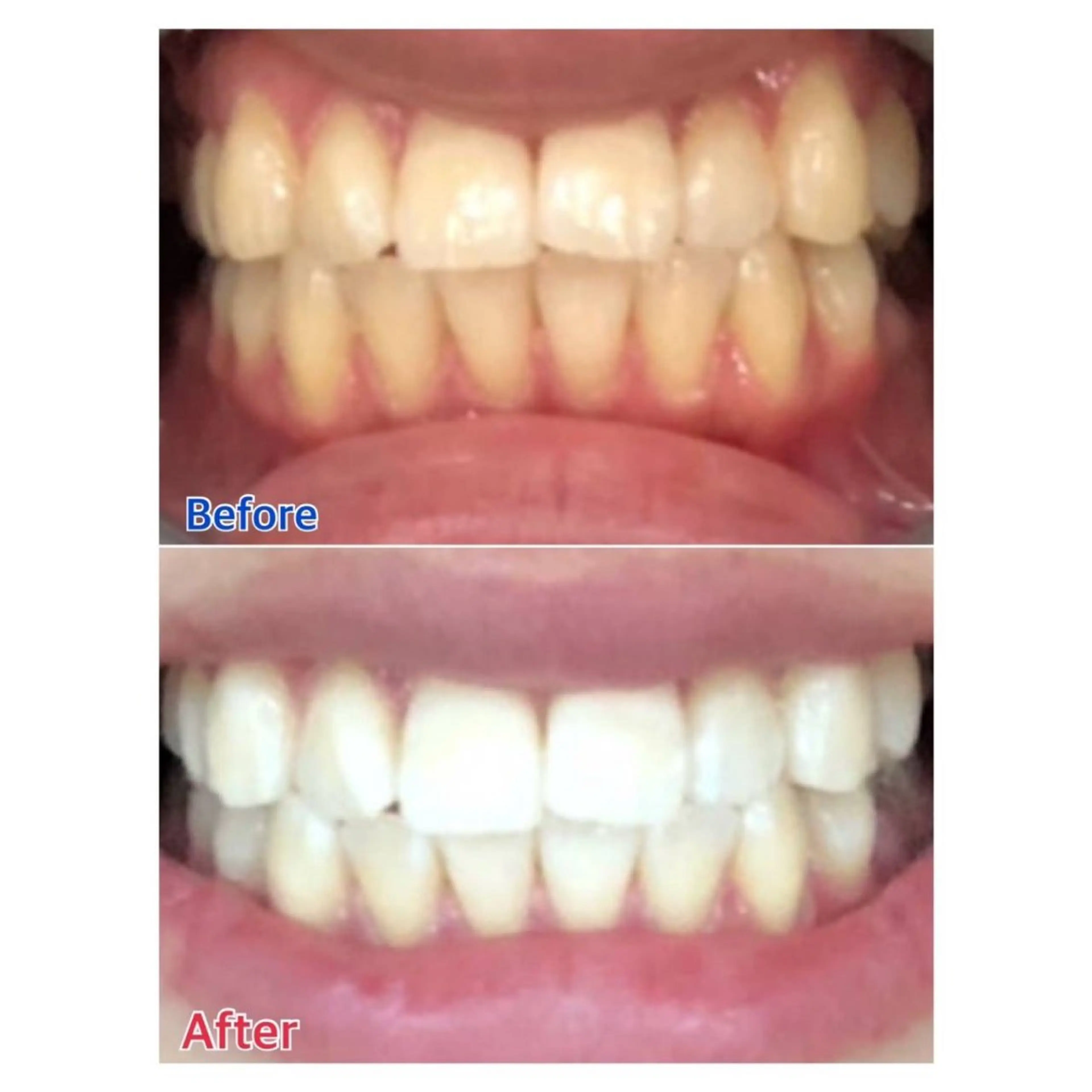 MBEAUTYSALON 千葉店・京成大久保所属・Melty 輝のその他イメージ