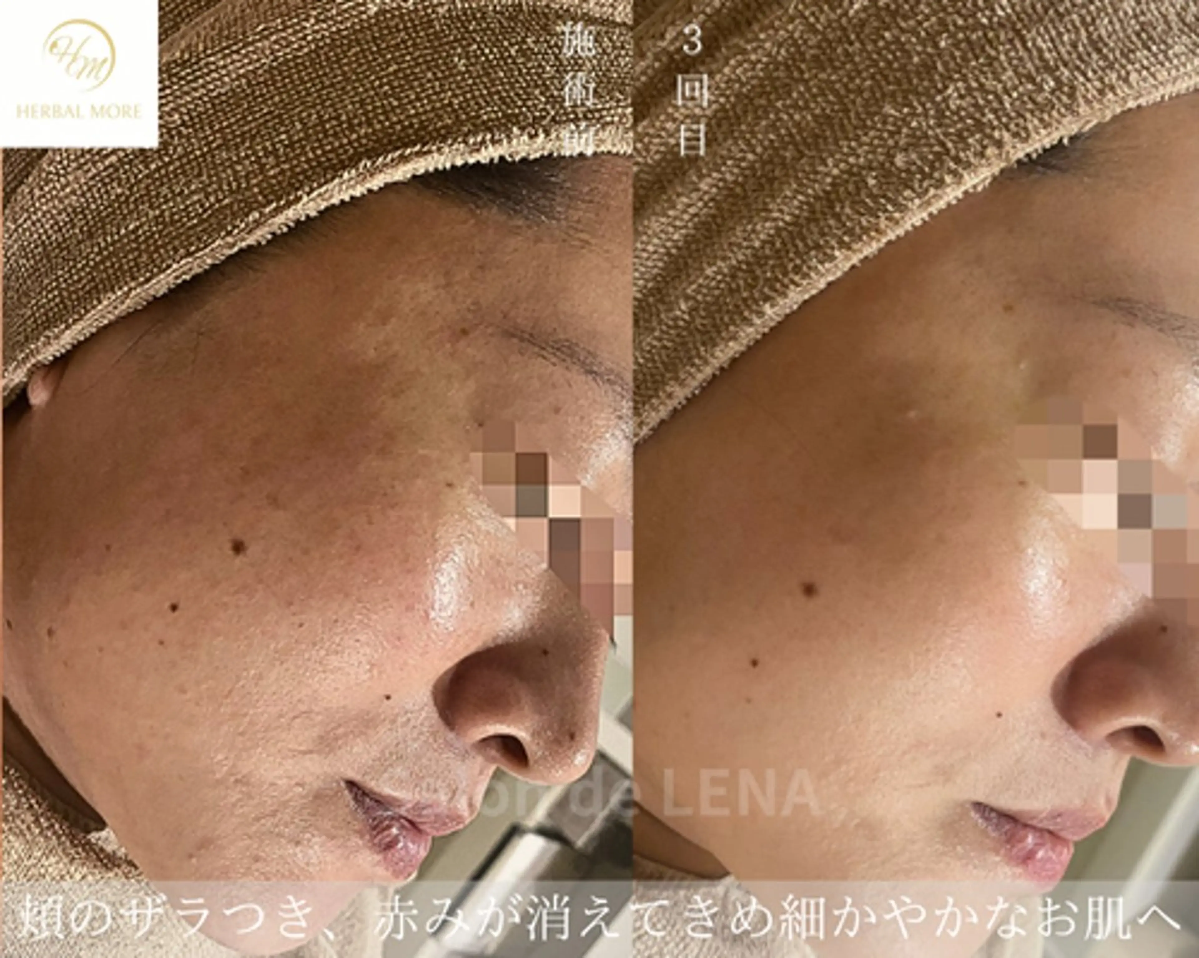 エステ サロンドレナ名駅店所属・ハーブピーリング専門 サロンドレナ平岡のエステ・リラクイメージ