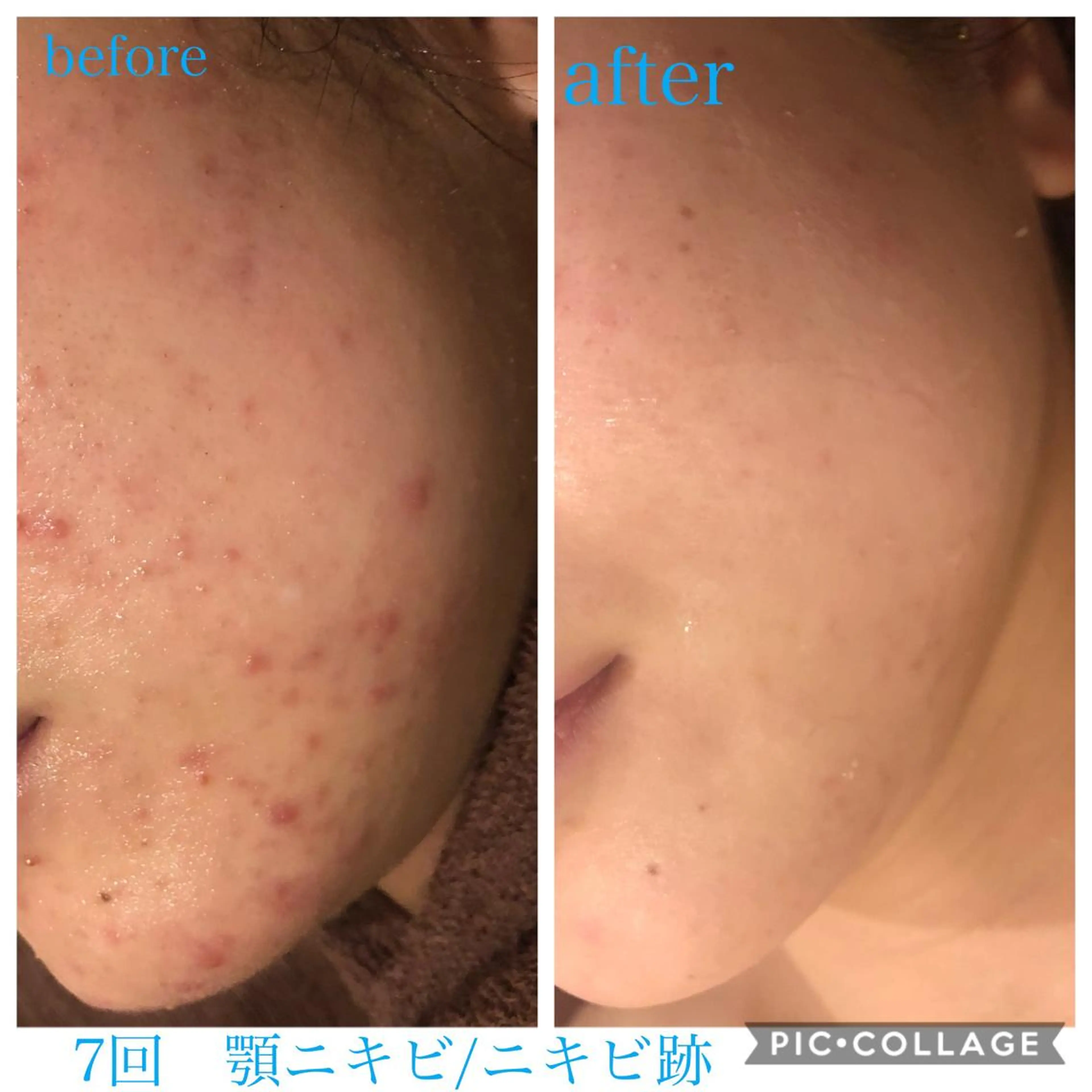 ショート カラー パーマ ヘアアレンジ キッズ ネイル マツエク・マツパ エステ リラク Ensor Clair所属・EnsorClair 代表　野口真央のエステ・リラクイメージ