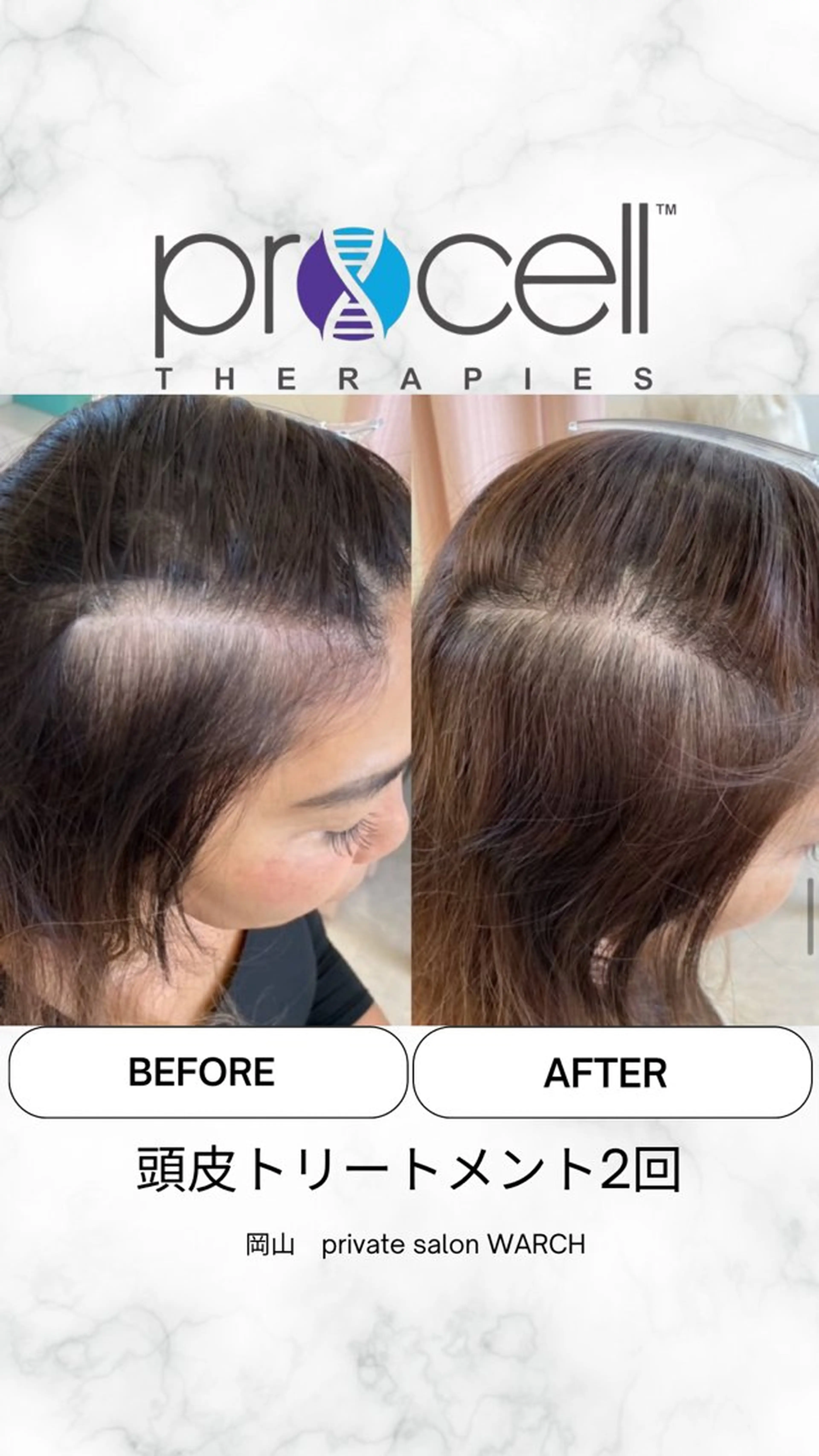 WARCH Marieのその他イメージ