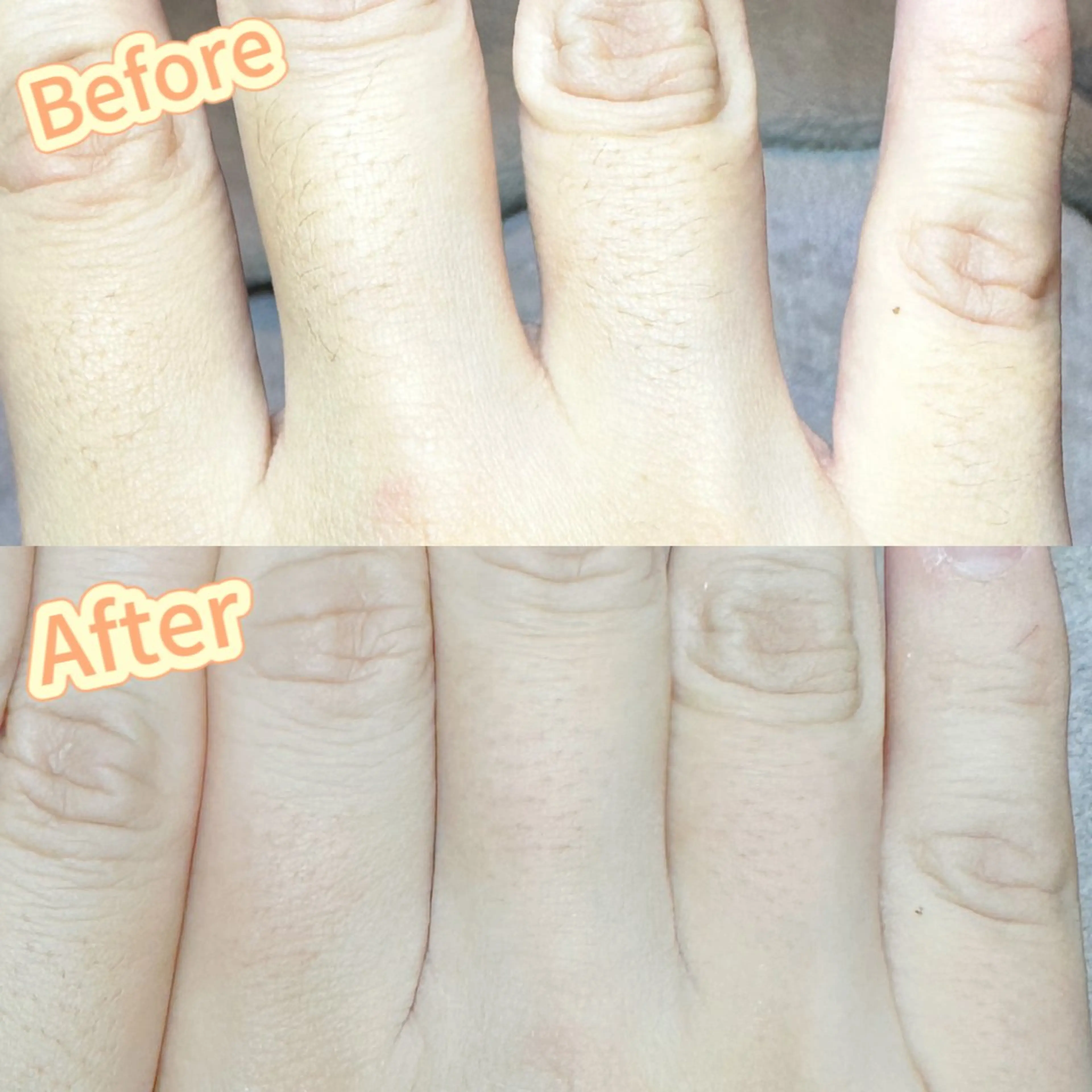 Hit. シュガーリング豊橋のエステ・リラクイメージ