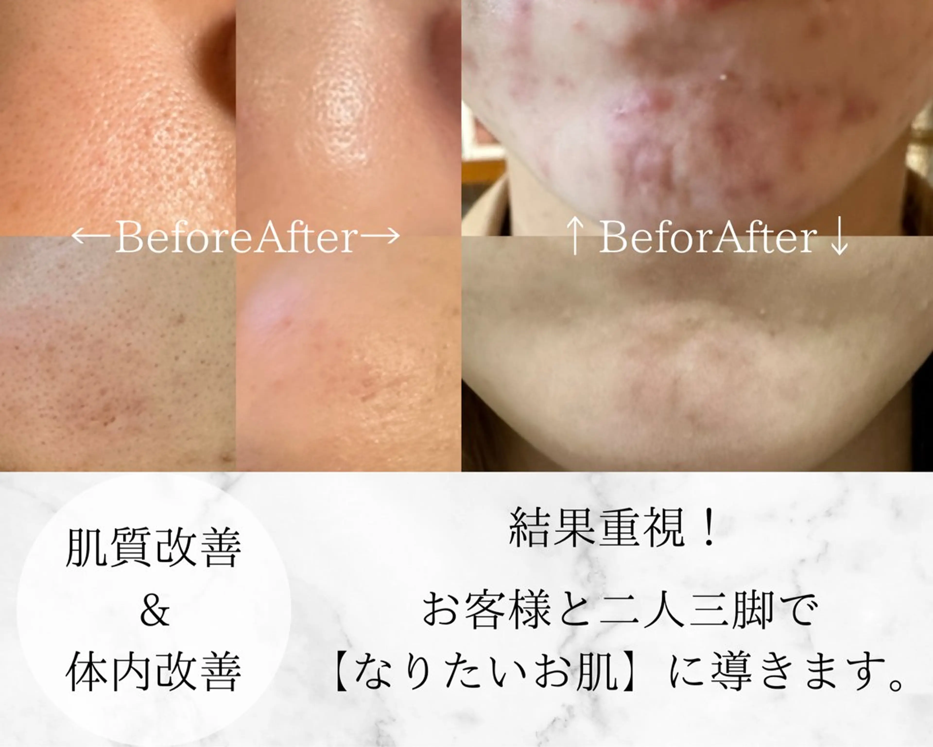 Ginza Charerのエステ・リラクイメージ