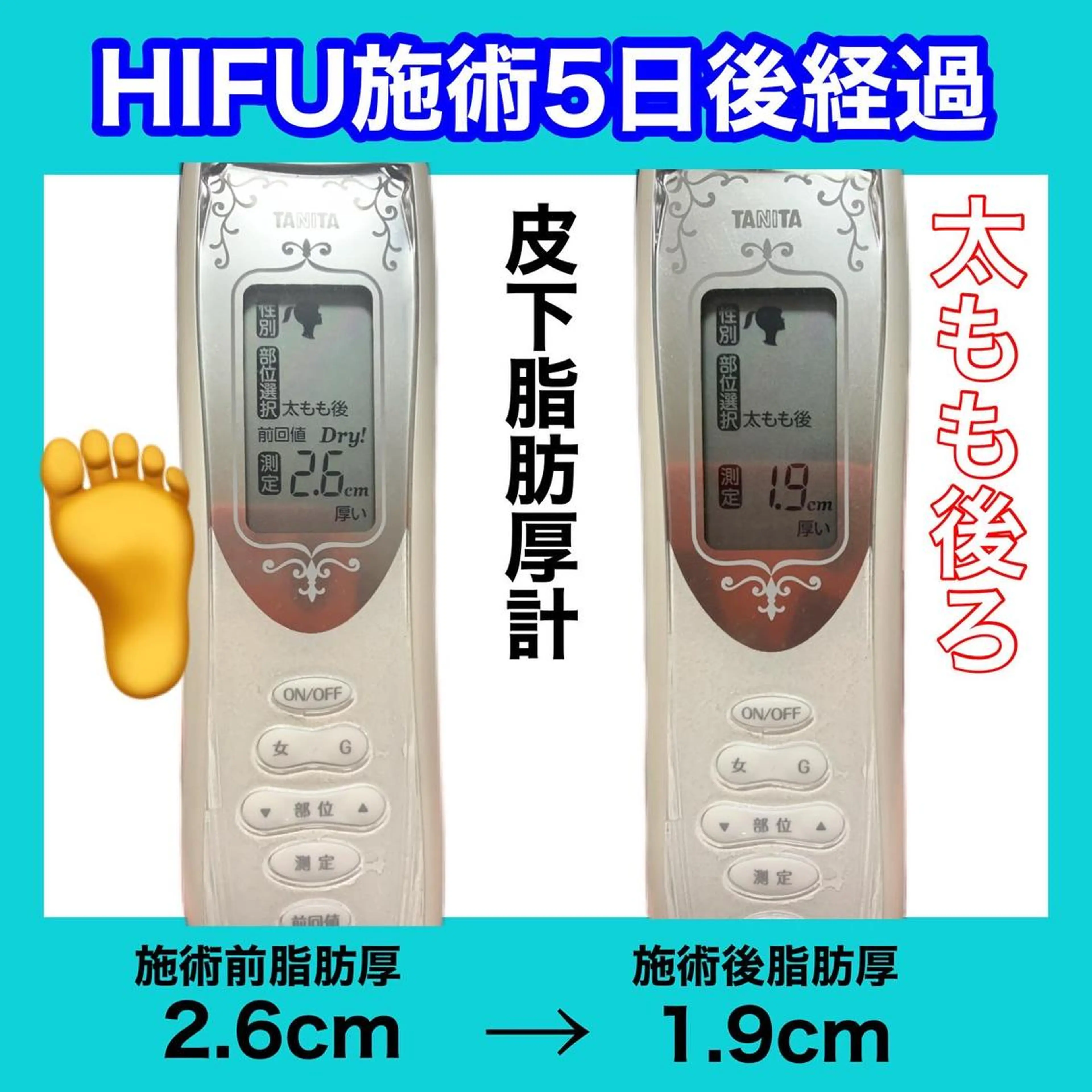 痩身/脱毛/ネイル HARUKAのエステ・リラクイメージ