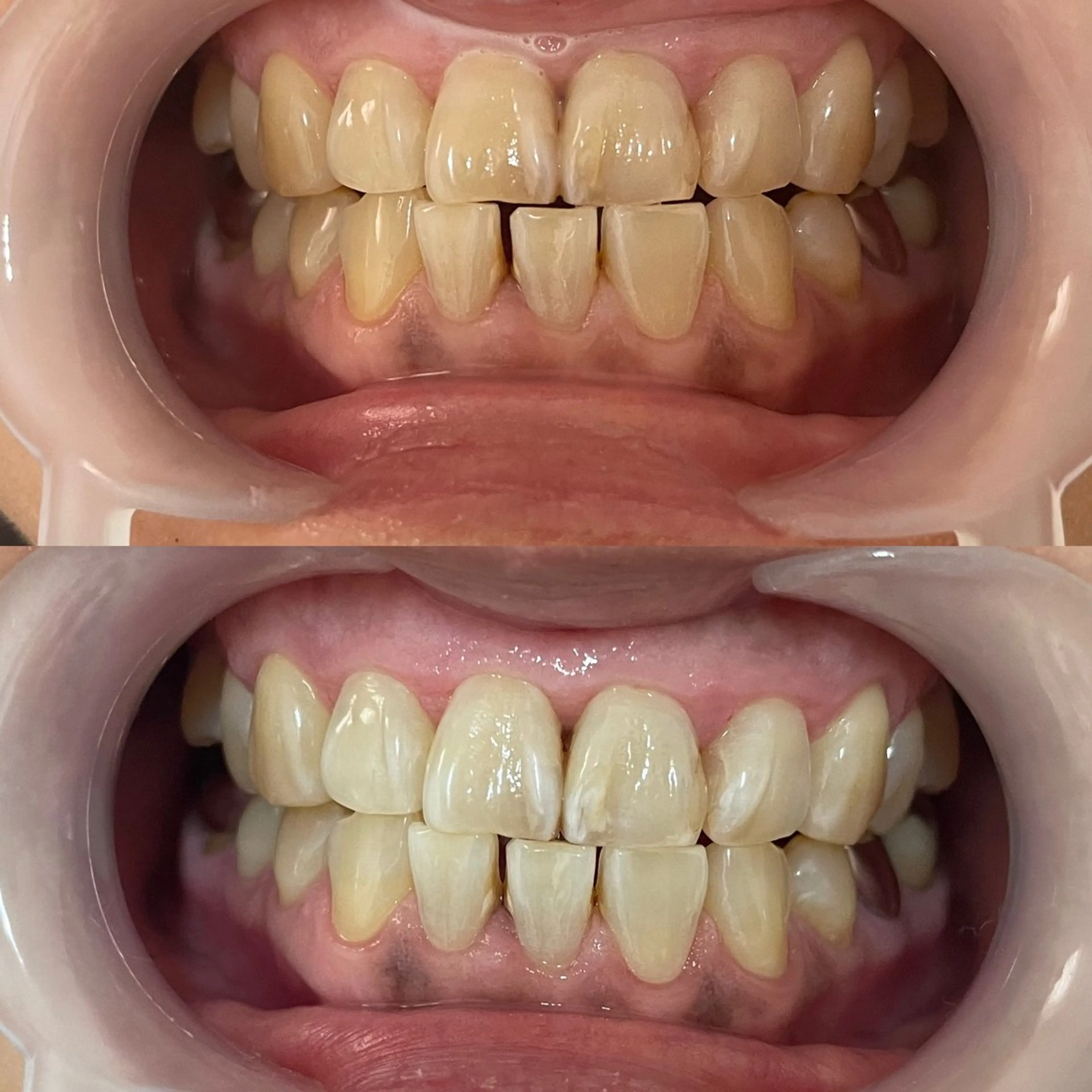 西宮ホワイトニング Kirarie所属・志水 有美のエステ・リラクイメージ