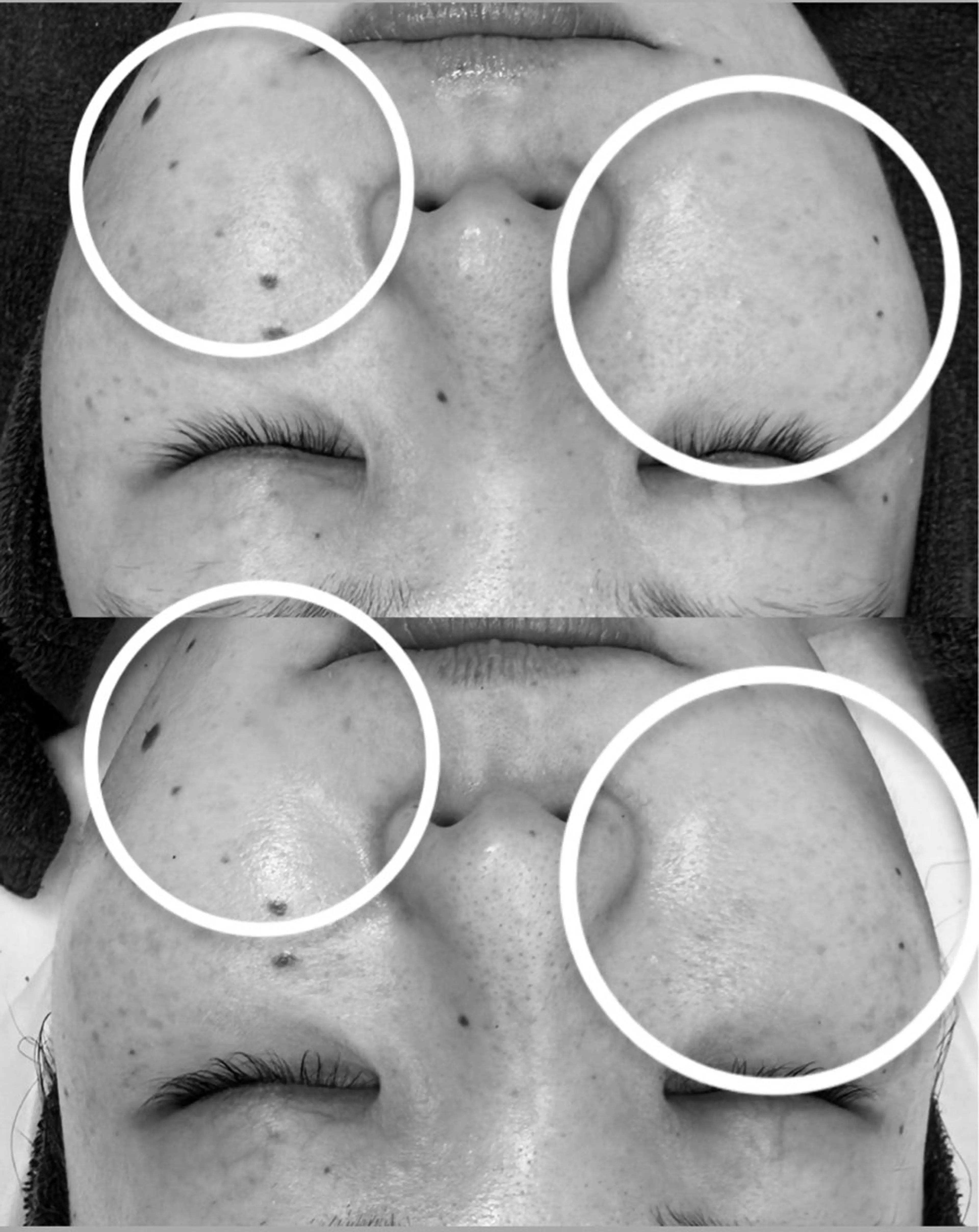 【シミケア・美白】HAABRBPROハーブリプロの写真