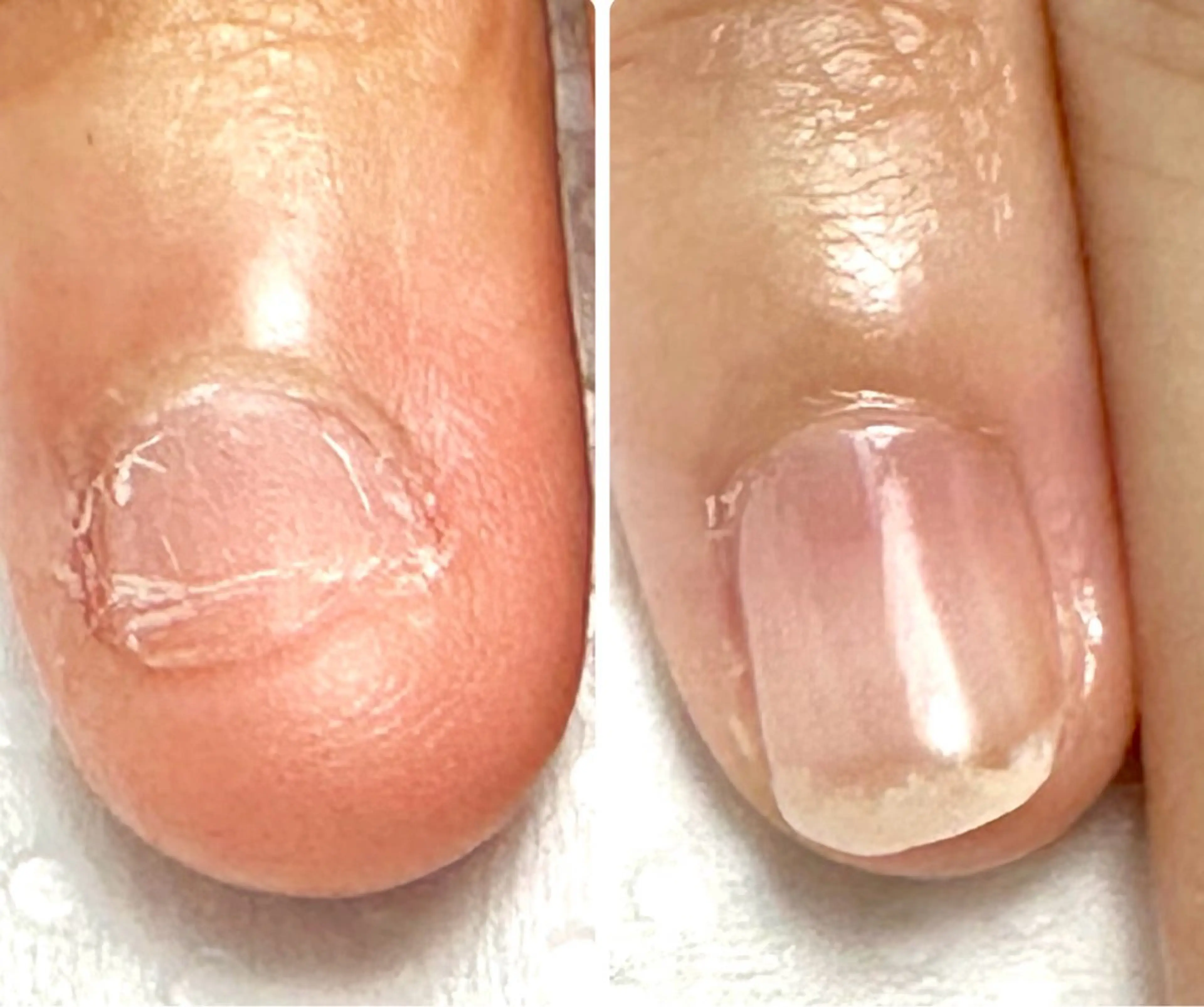 ネイル 自爪育成サロン ラムールのネイルデザイン