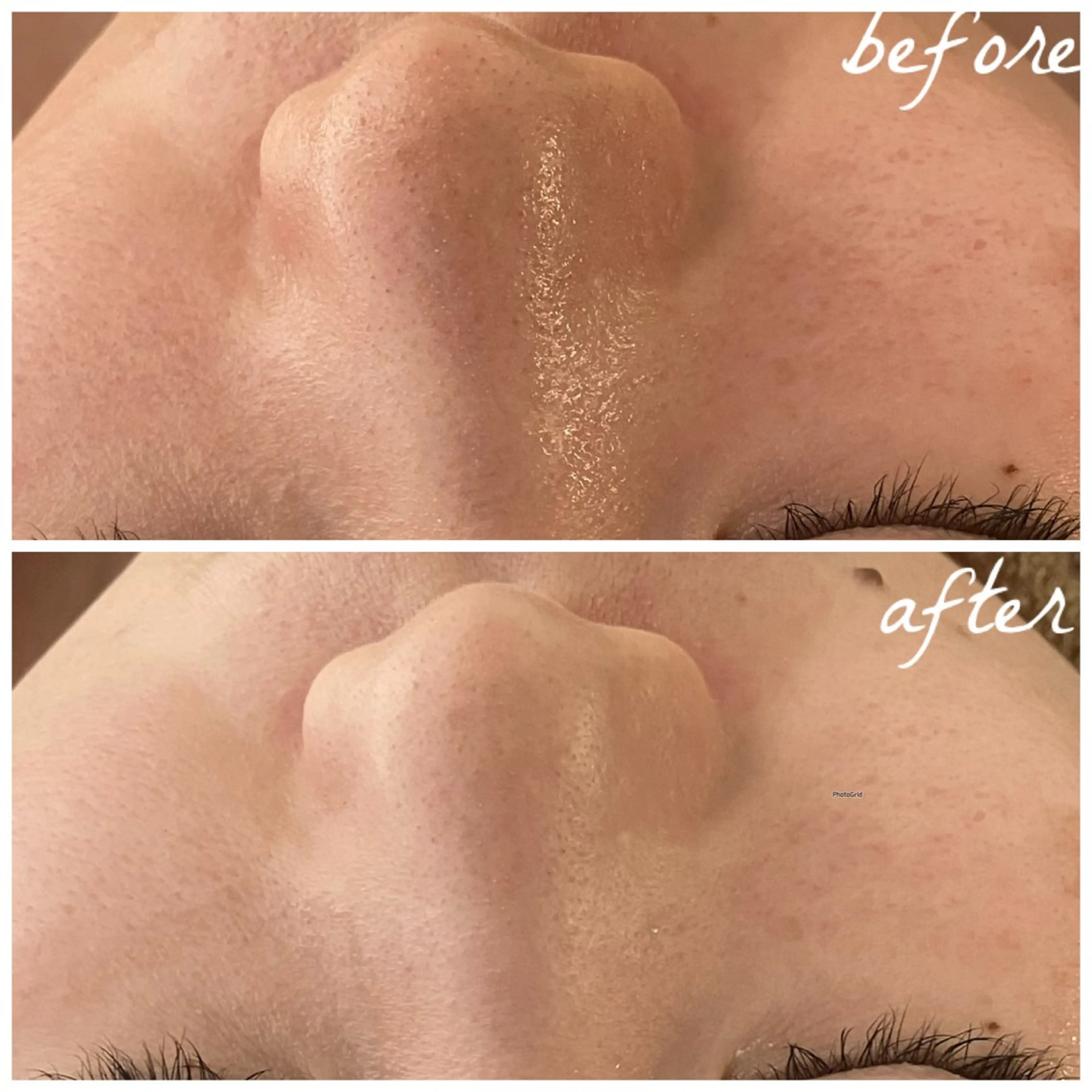 メンズ エステ メナード岐阜茜部 杉浦のエステ・リラクイメージ