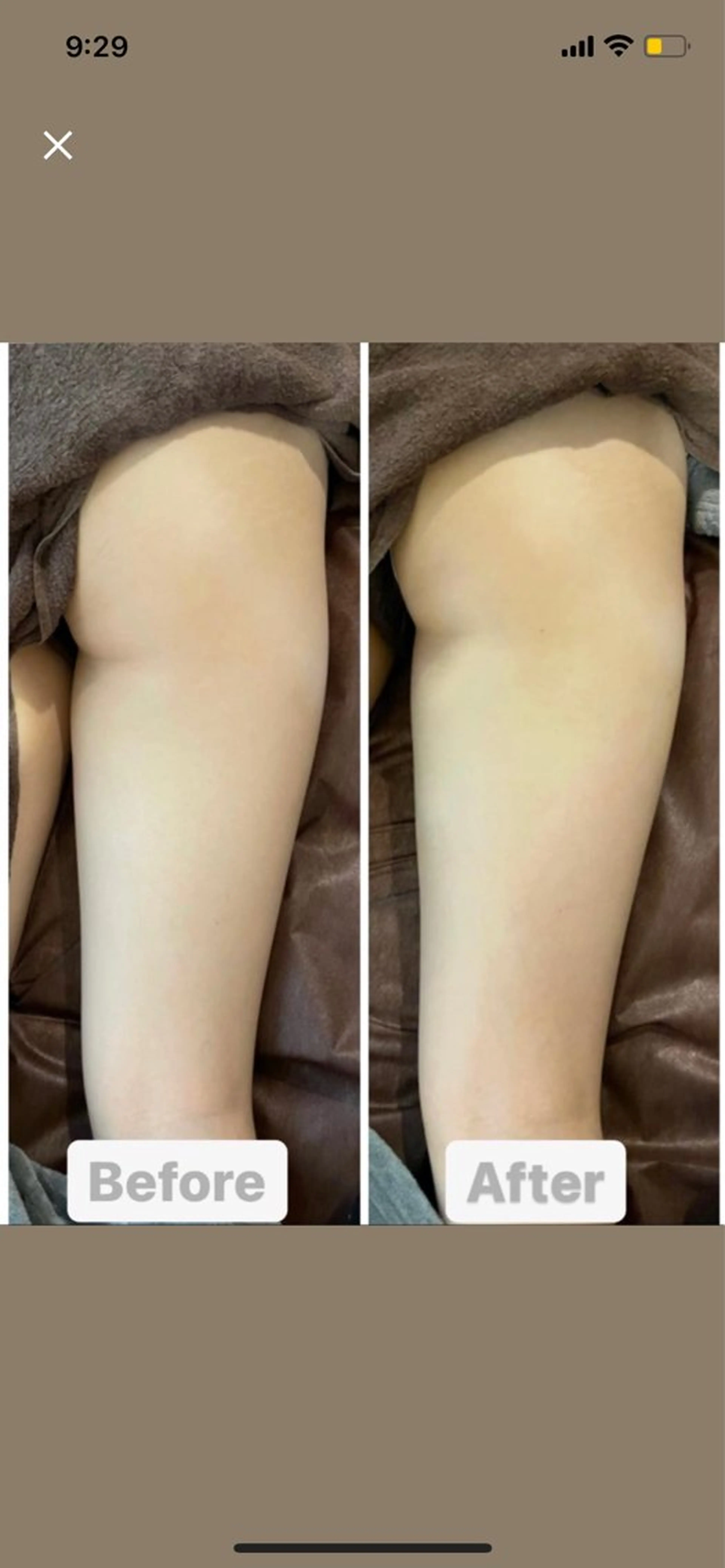 Jeune【ジューヌ】所属・Jeune RINAのエステ・リラクイメージ