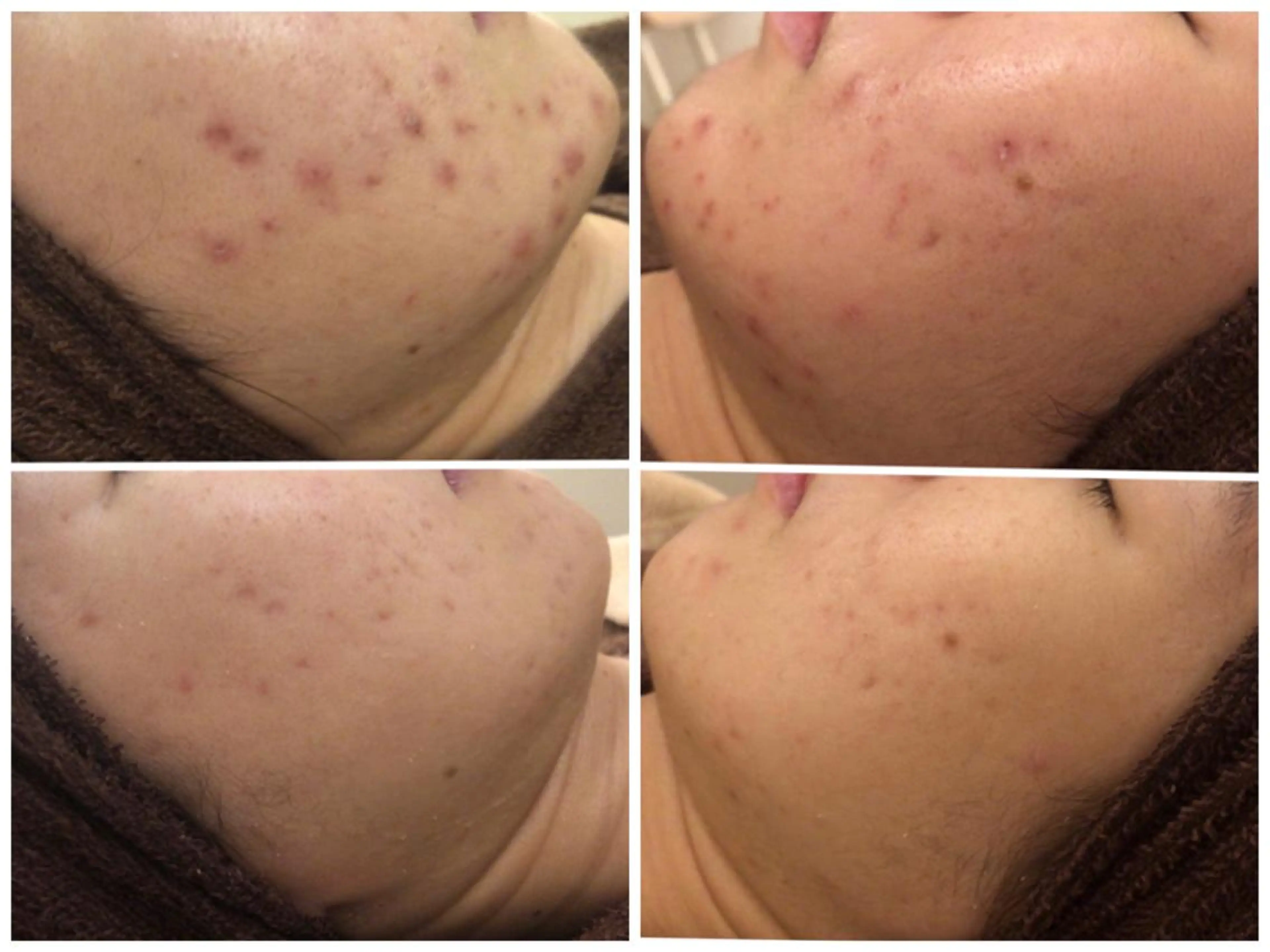 ミディアム カラー パーマ ヘアアレンジ メンズ キッズ ネイル マツエク・マツパ エステ リラク ニキビ・肌質改善専門 ♡人生が変わるサロンのエステ・リラクイメージ