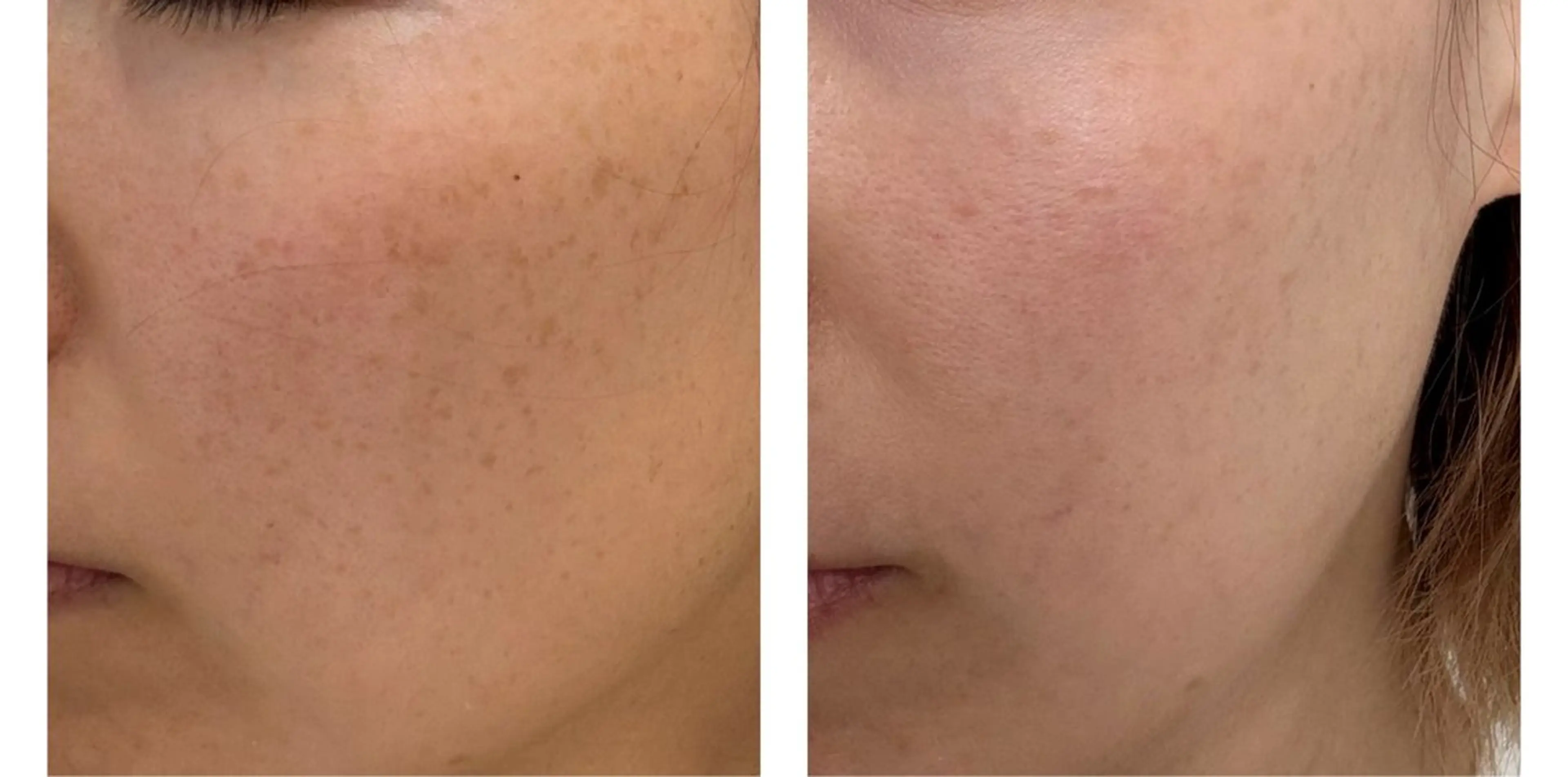 エステ リラク marrina terraceのその他イメージ